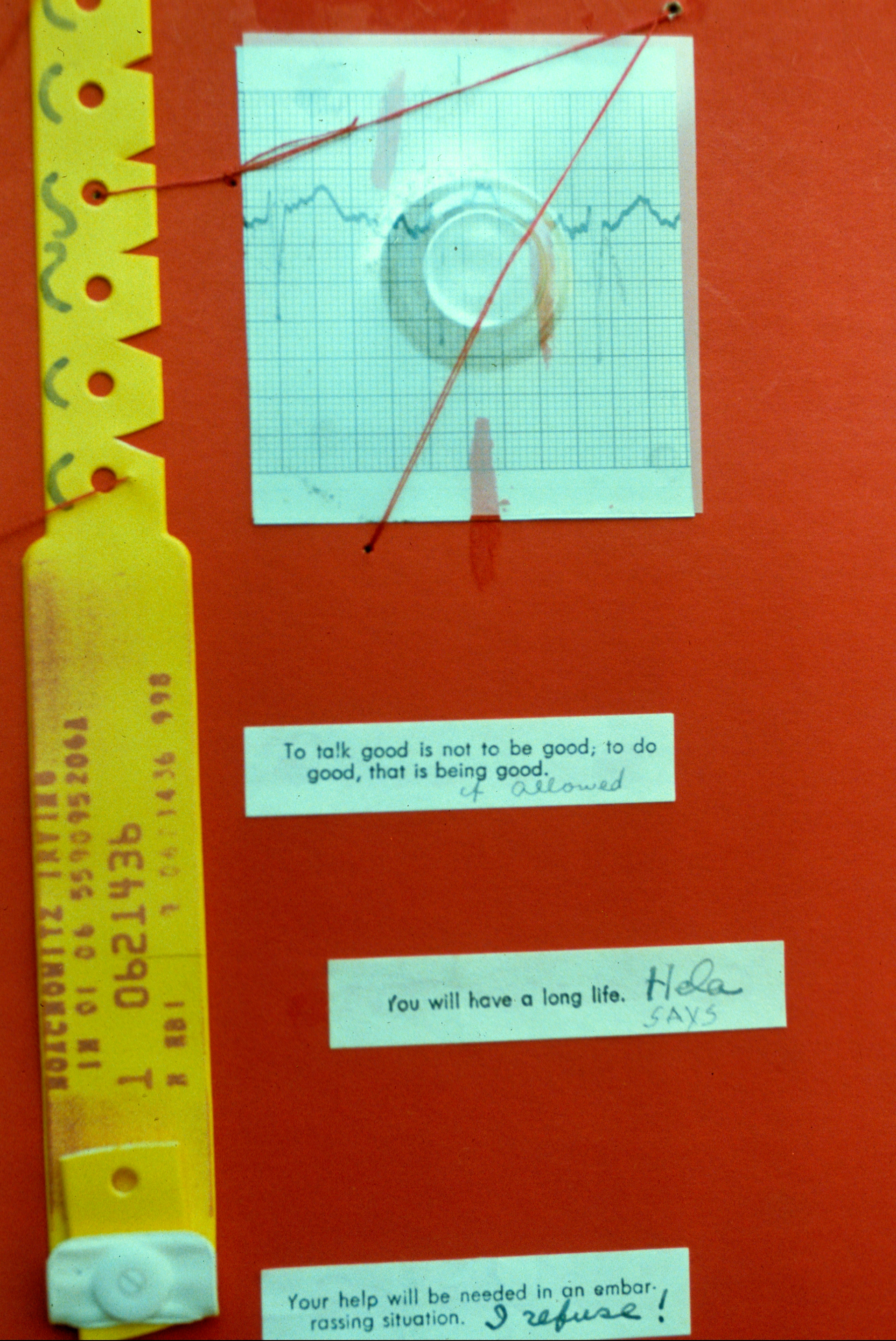 ca1987 - Heart Attack (detail-02)