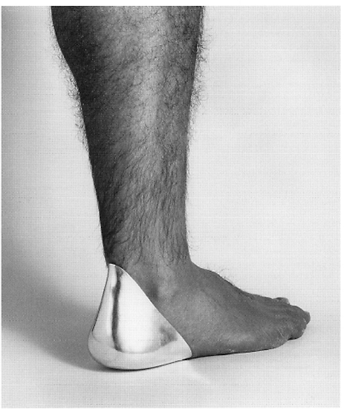 achilles heel 1978