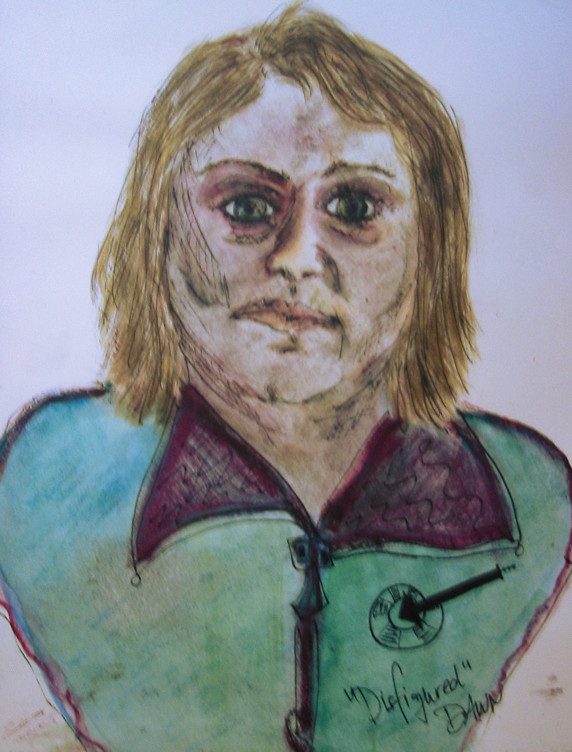 Disfigured