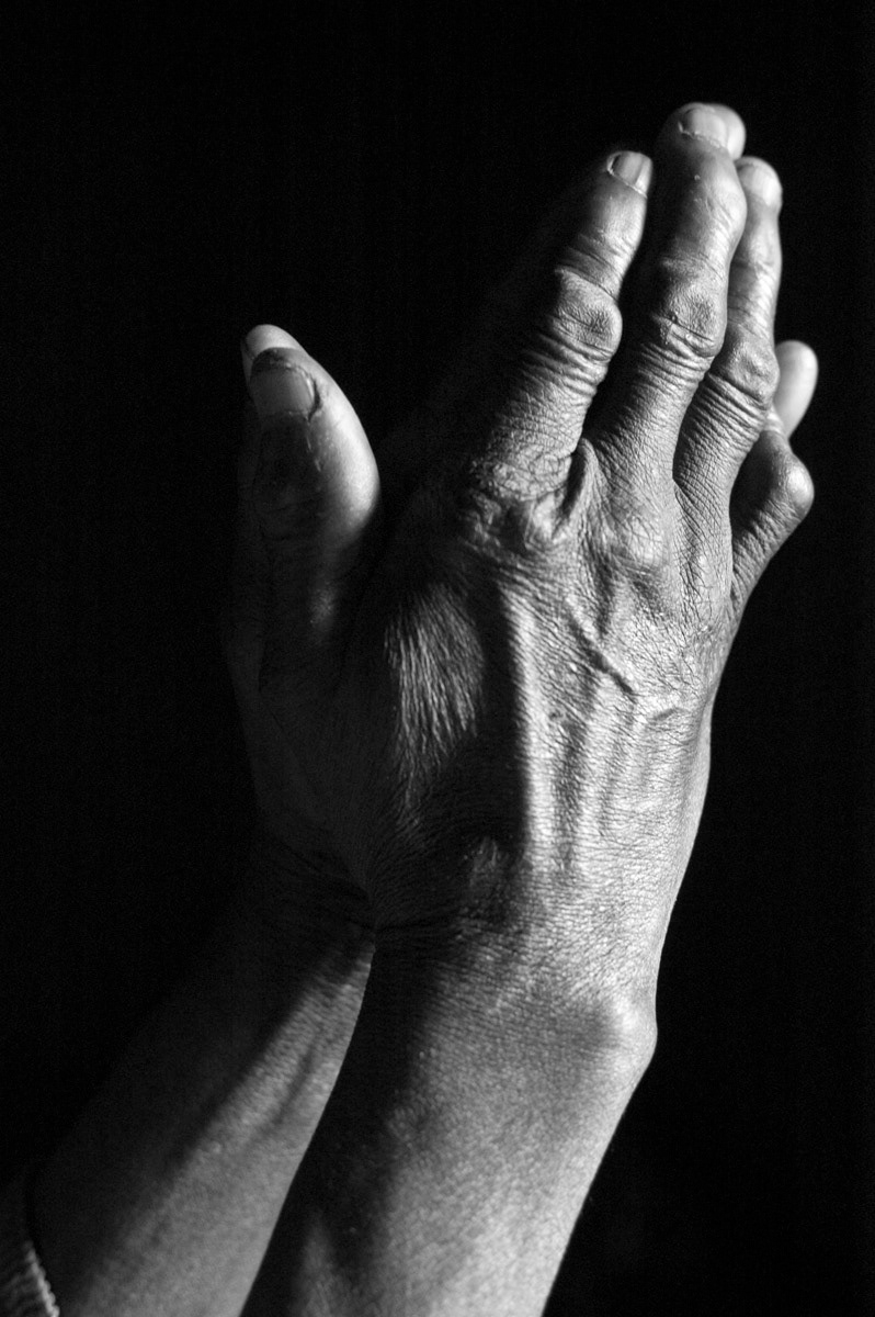 'Kibakuli', 70, was alone in her house when the attackers came. It was midnight. “They stabbed me in the head and on the top of my arms with a machete as they forced my hands behind my head. I was screaming all the time as they raped me, all five of them, one by one. As one was raping me another would say; “get out so I can enter”. They hit my hand with a stick and it is now damaged. When they left I crawled out of the house. They were burning houses in the village and then burnt mine. They left me with Fistula but I was cured by DOCS (Doctors on Call for Service in Goma - now called HEAL Africa). I couldn’t stay long with Fistula, the smell was so bad from the urine.”