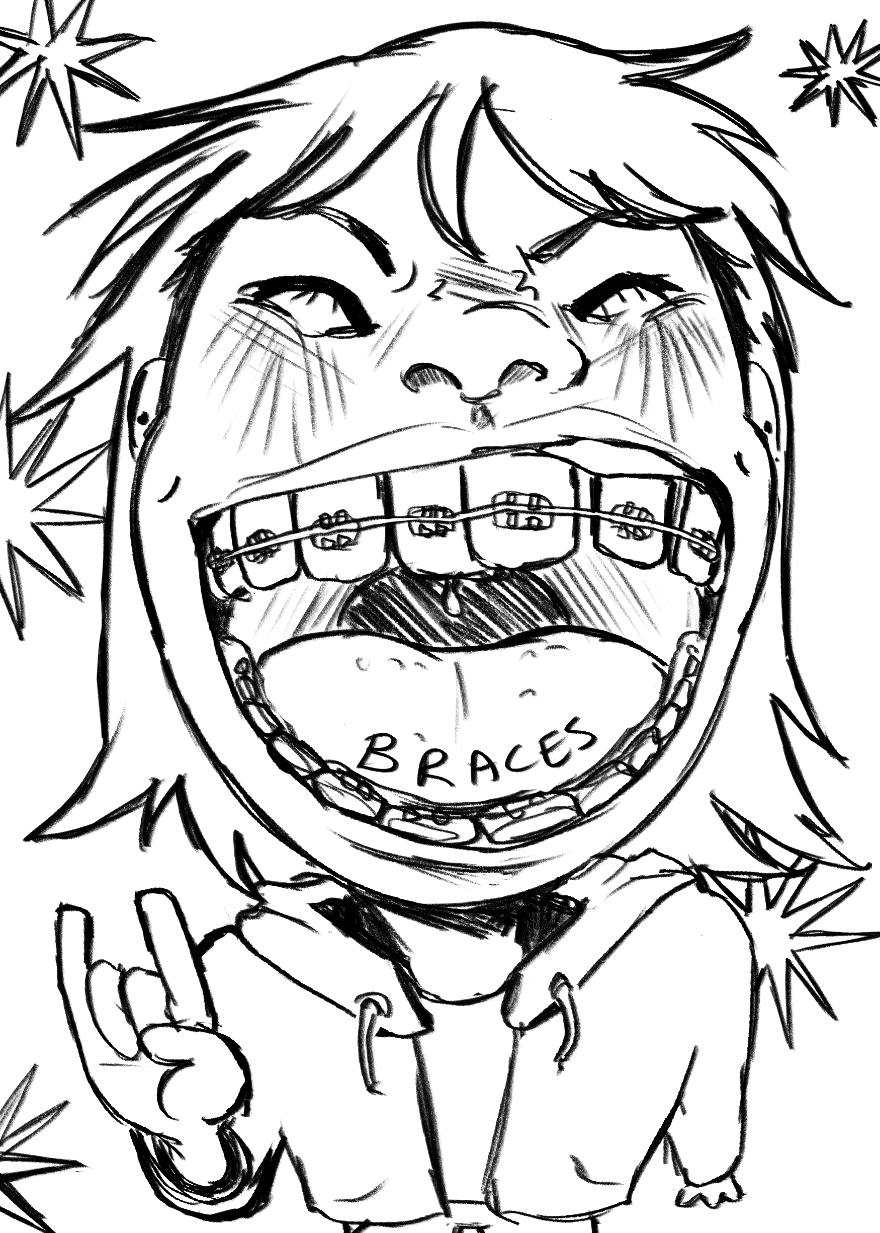 braces