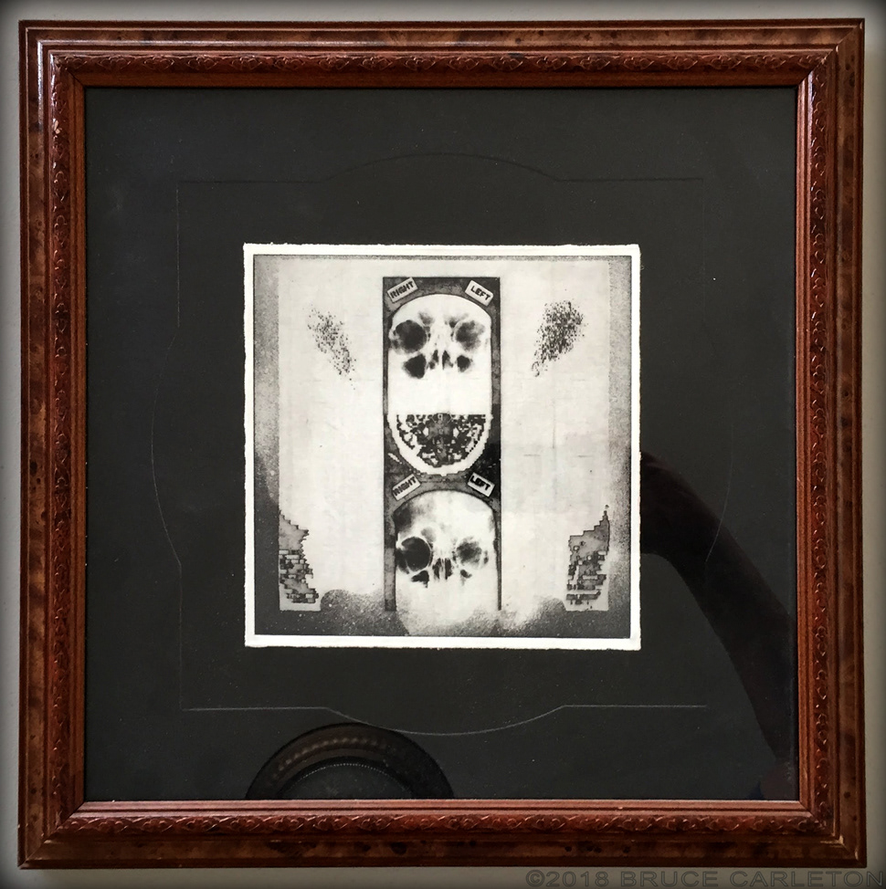 “Right/Left/Left/Right MEDIUM: photoetching combined with traditional etching STORY: Here I was able to combine the two things I liked doing most at the time: intaglio printing and the use of photos in my art.