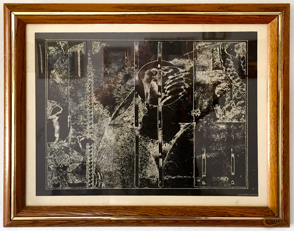 “Radiograph” MEDIUM: photoetching STORY: I was excited with the idea of using photos in my prints and thought this was the angle I wanted to pursue.