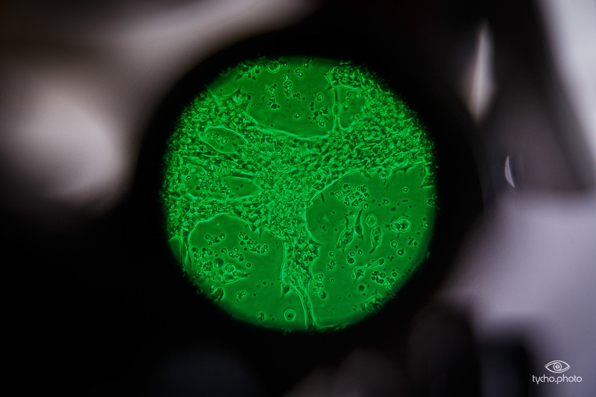 Pluriomics (hartcellen)