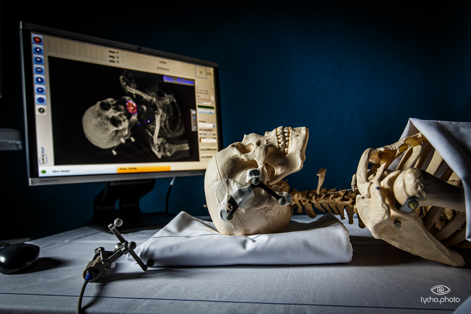 LUMC Image Guided Surgery