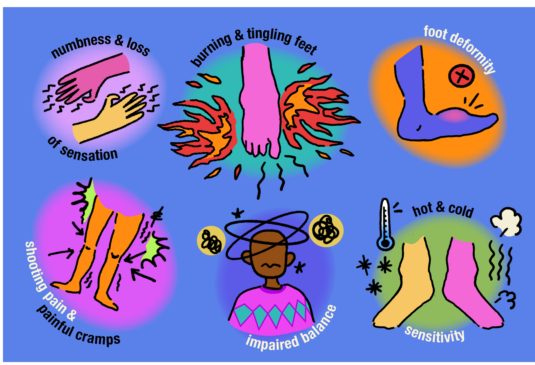 Symptoms of Neuropathy Diabetic Peripheral