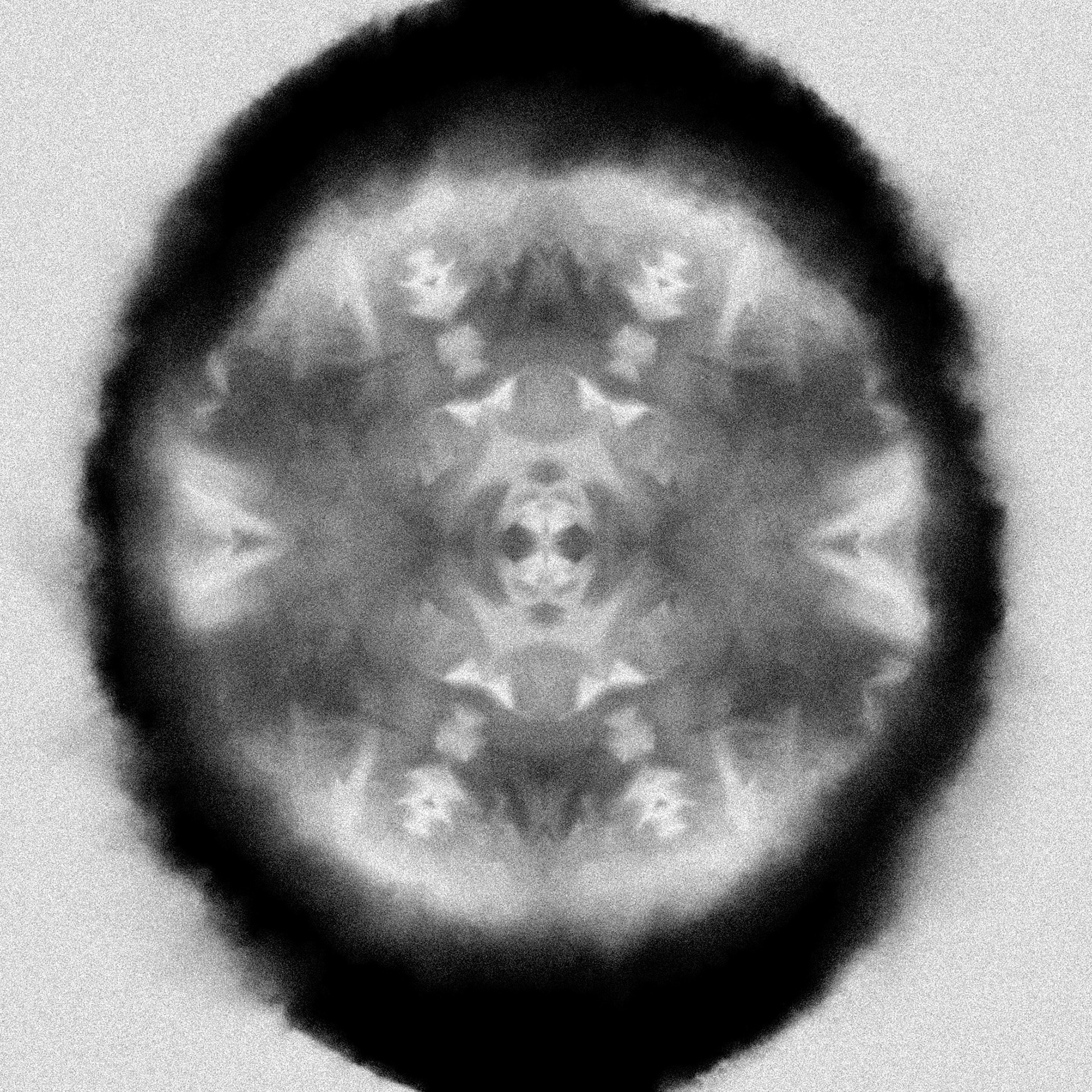 X-Ray Diffraction