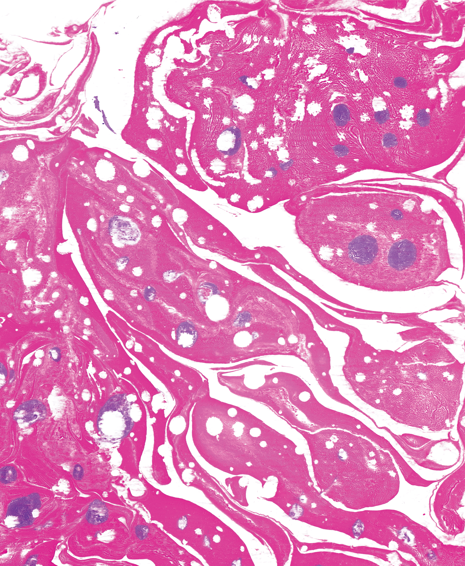 Front Cover for Amanda Quaid's book "No Obvious Distress" - Created for the John Murray live brief