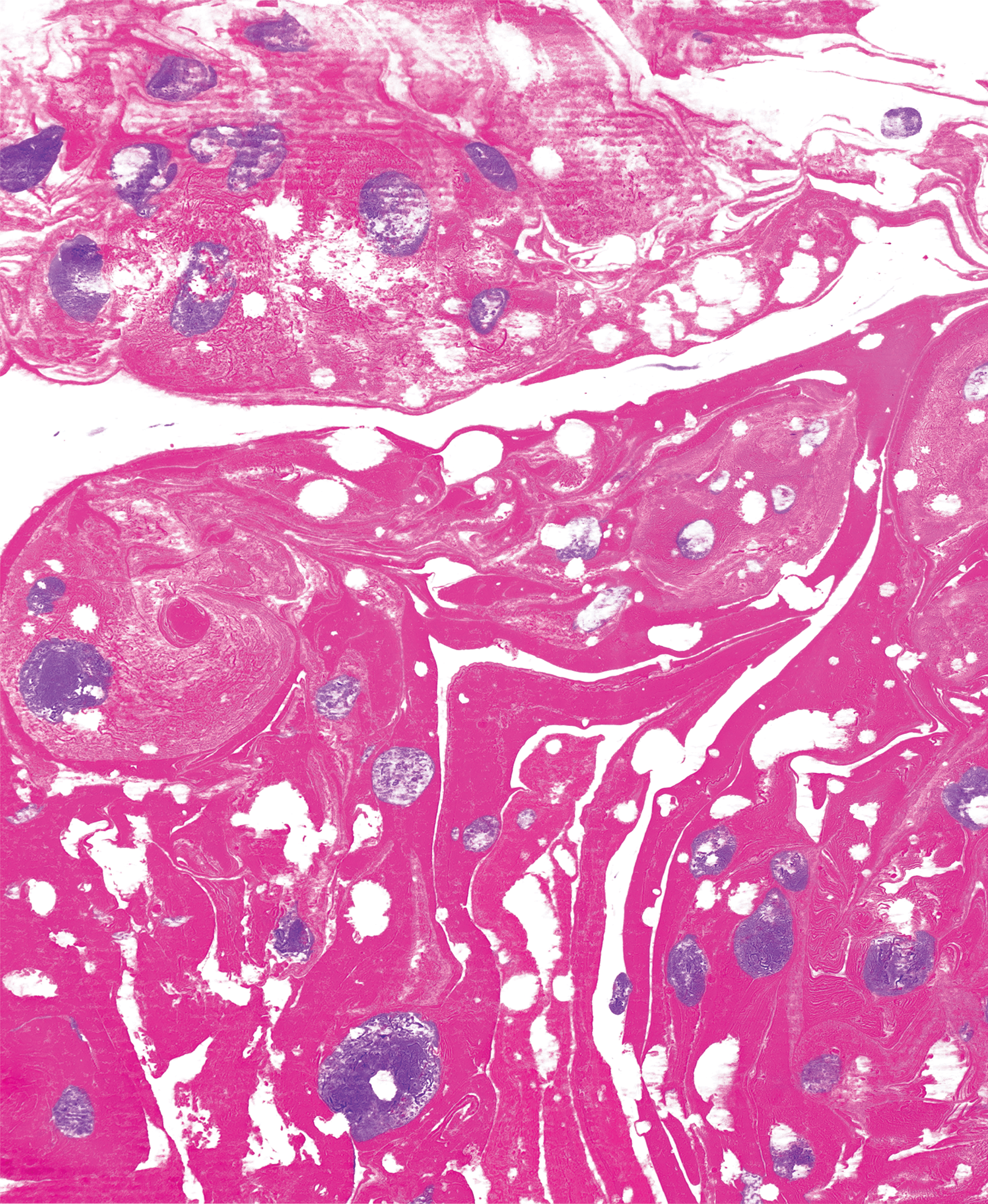 Back Cover for Amanda Quaid's book "No Obvious Distress" - Created for the John Murray live brief