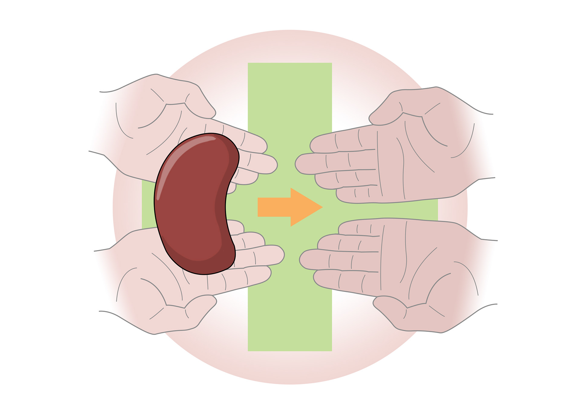 The long term treatment is kidney transplant