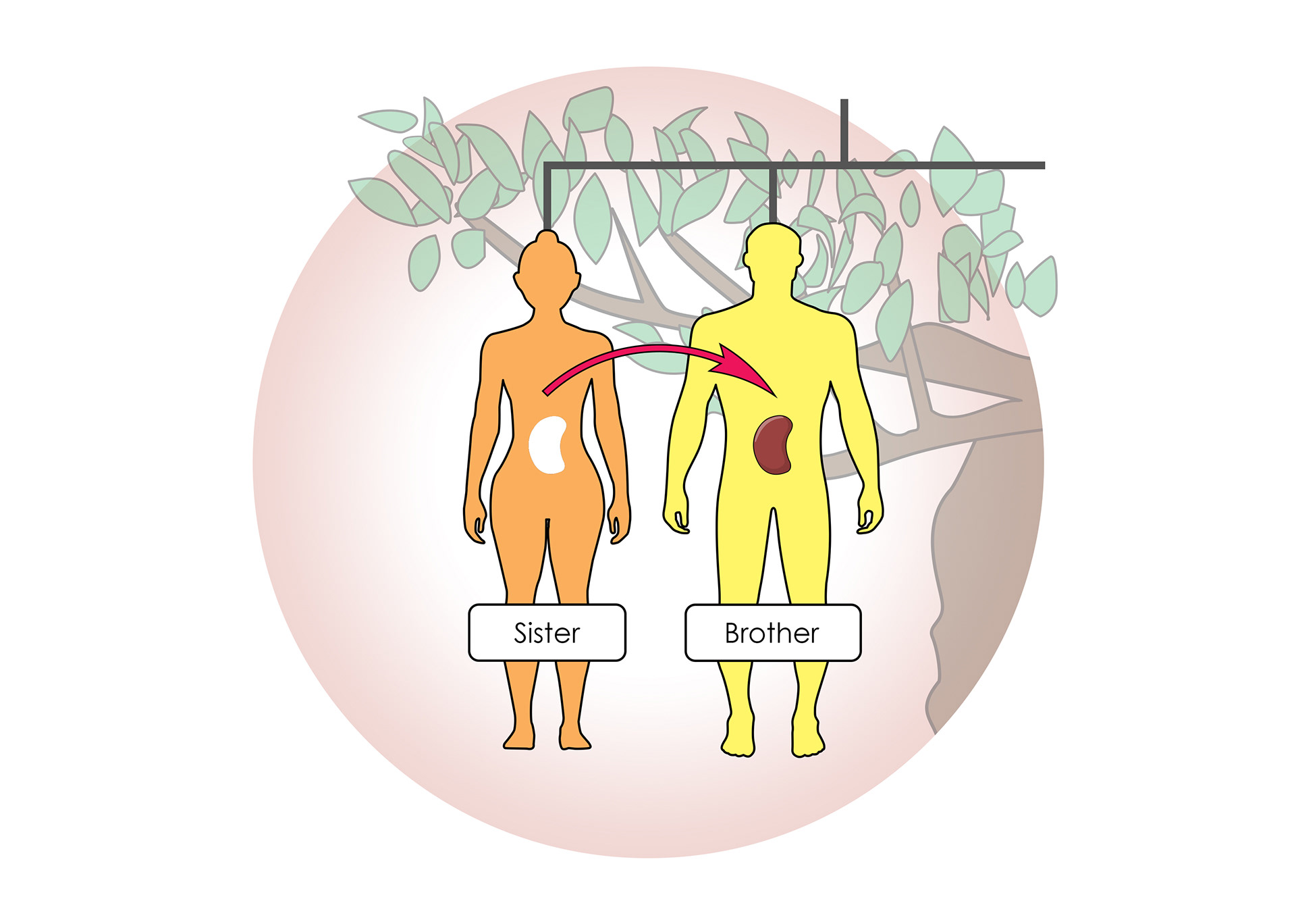 A close relative can donate a kidney
