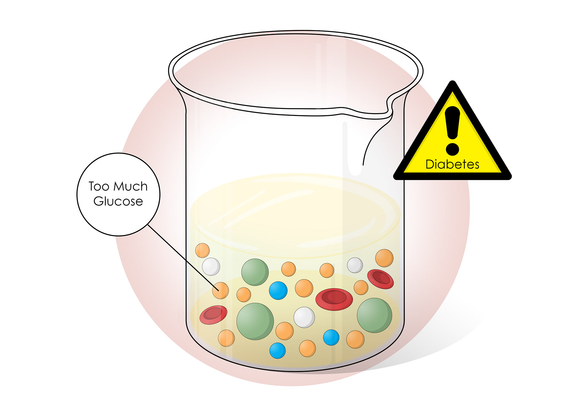 Too much glucose can signify diabetes