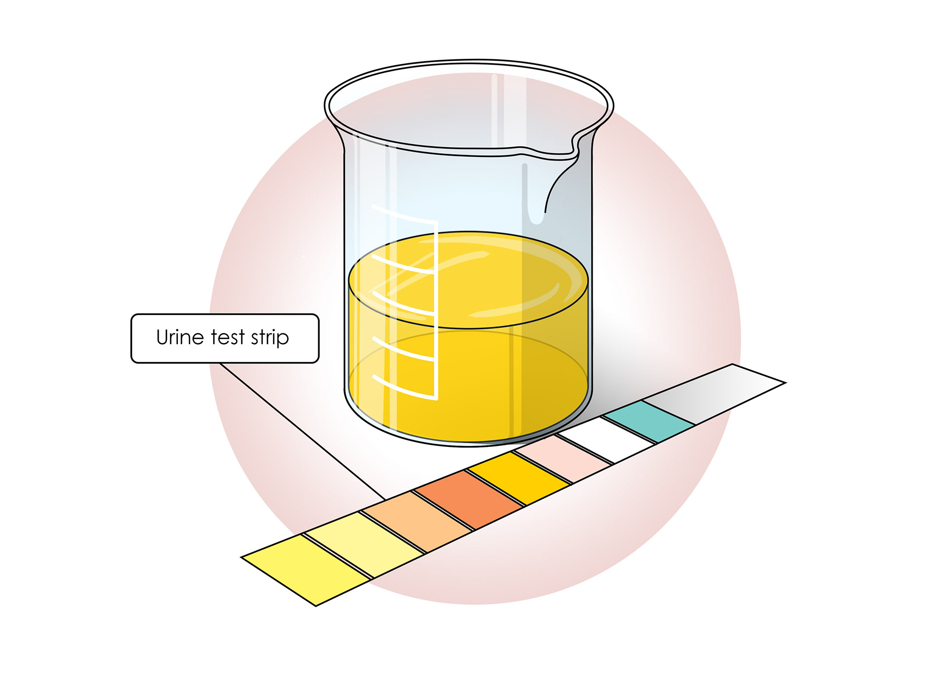 Testing urine can check if the kidneys are working properly
