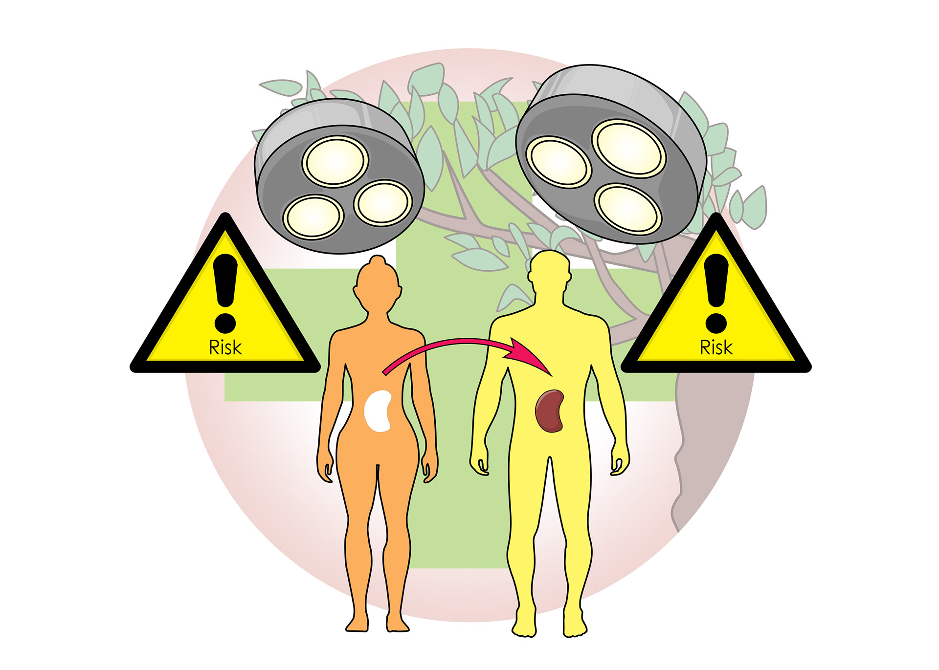 There is risk for both the patient and the donor