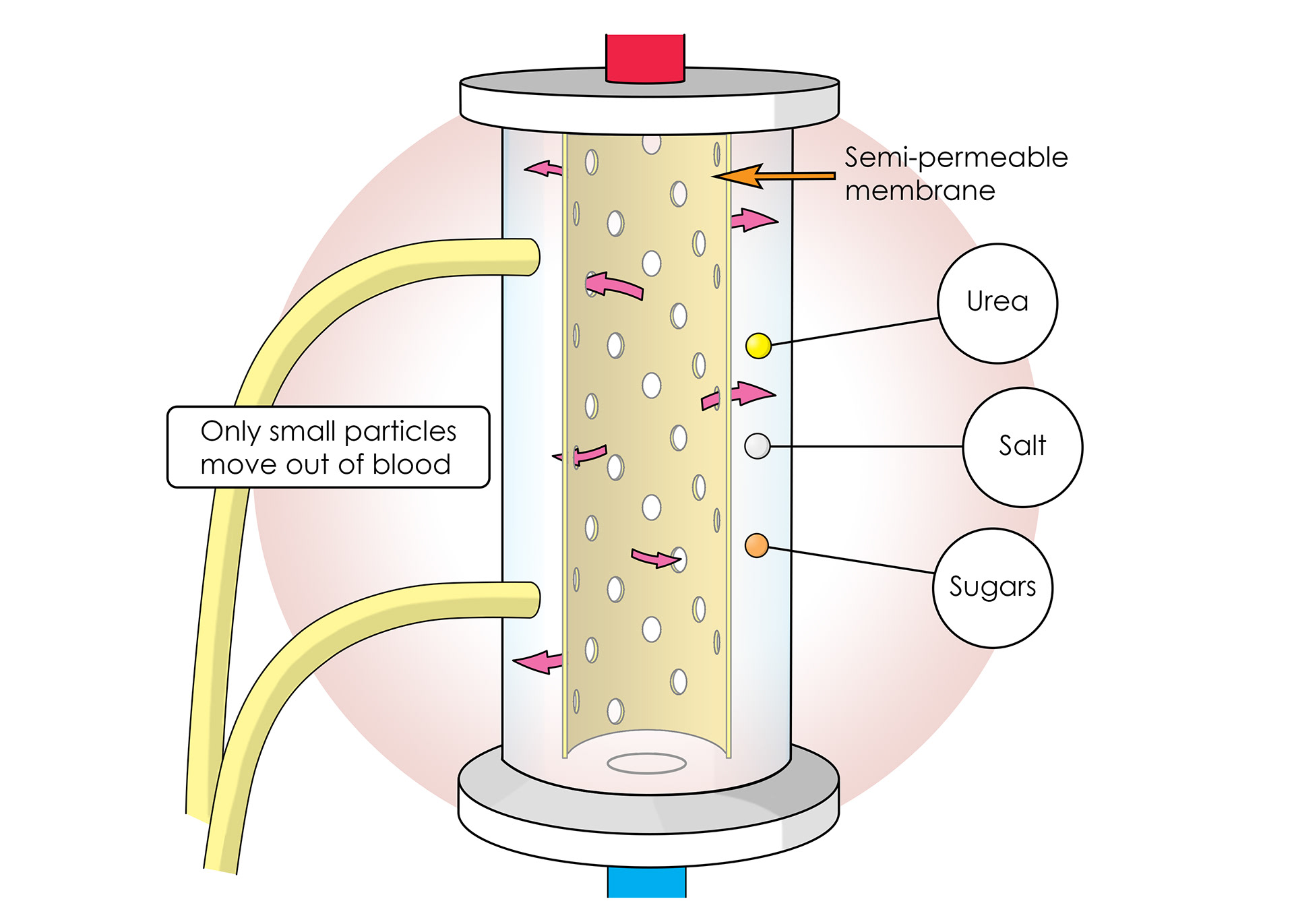 Semi-permeable membrane inside the machine only lets small particles move out of blood
