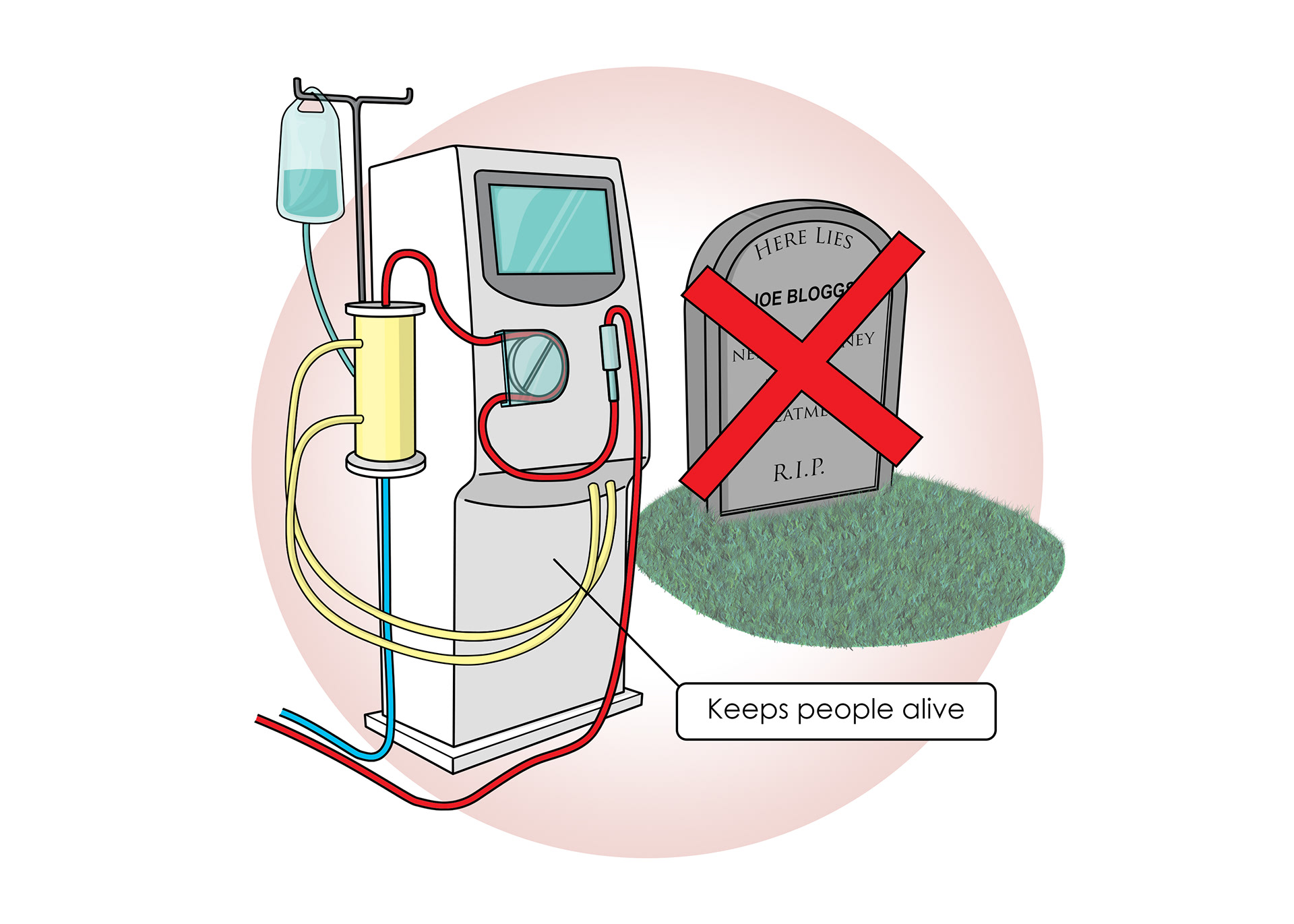 Dialysis keeps people alive