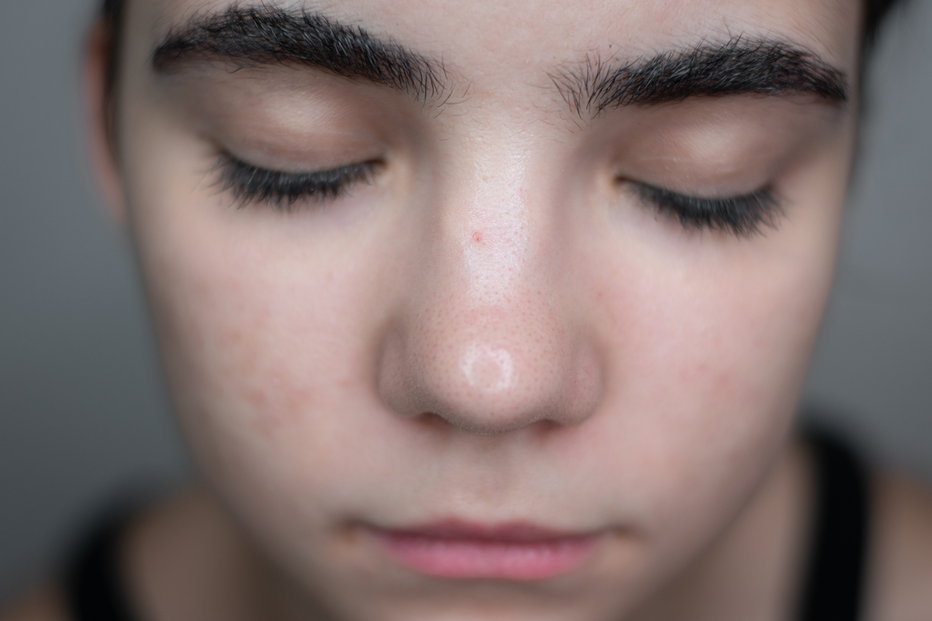 Wide nose