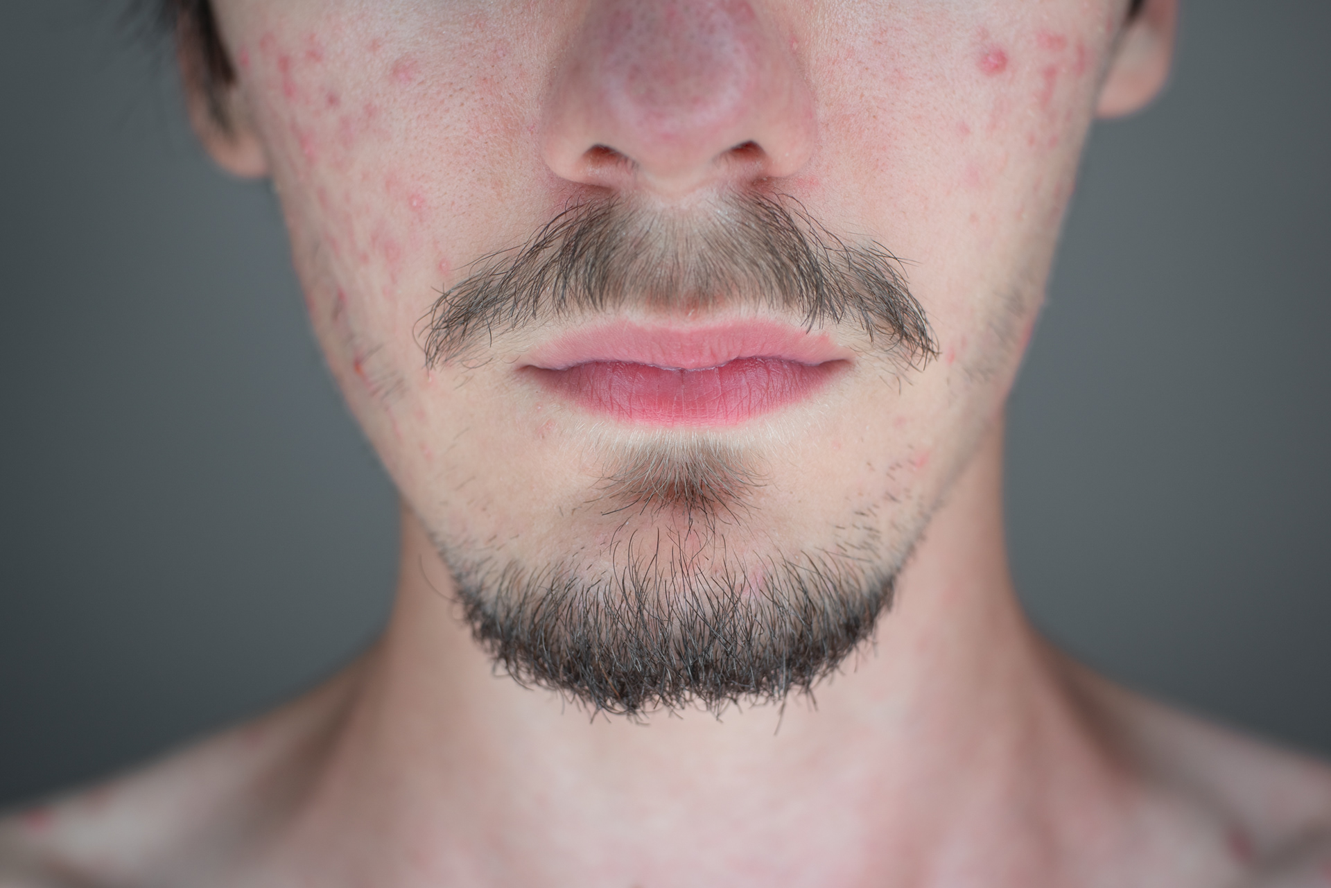 Asymmetrical jaw