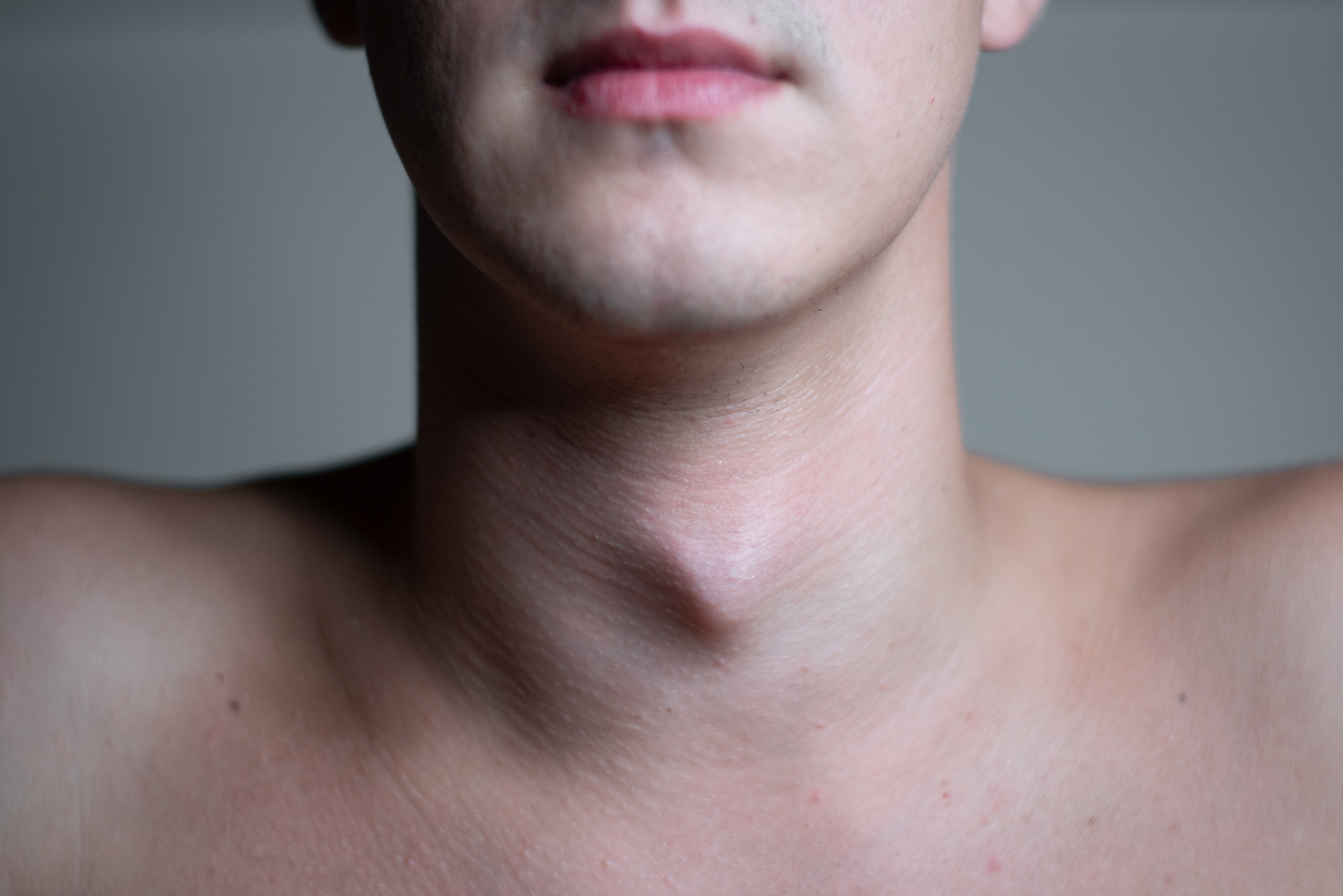 Large Adam's apple