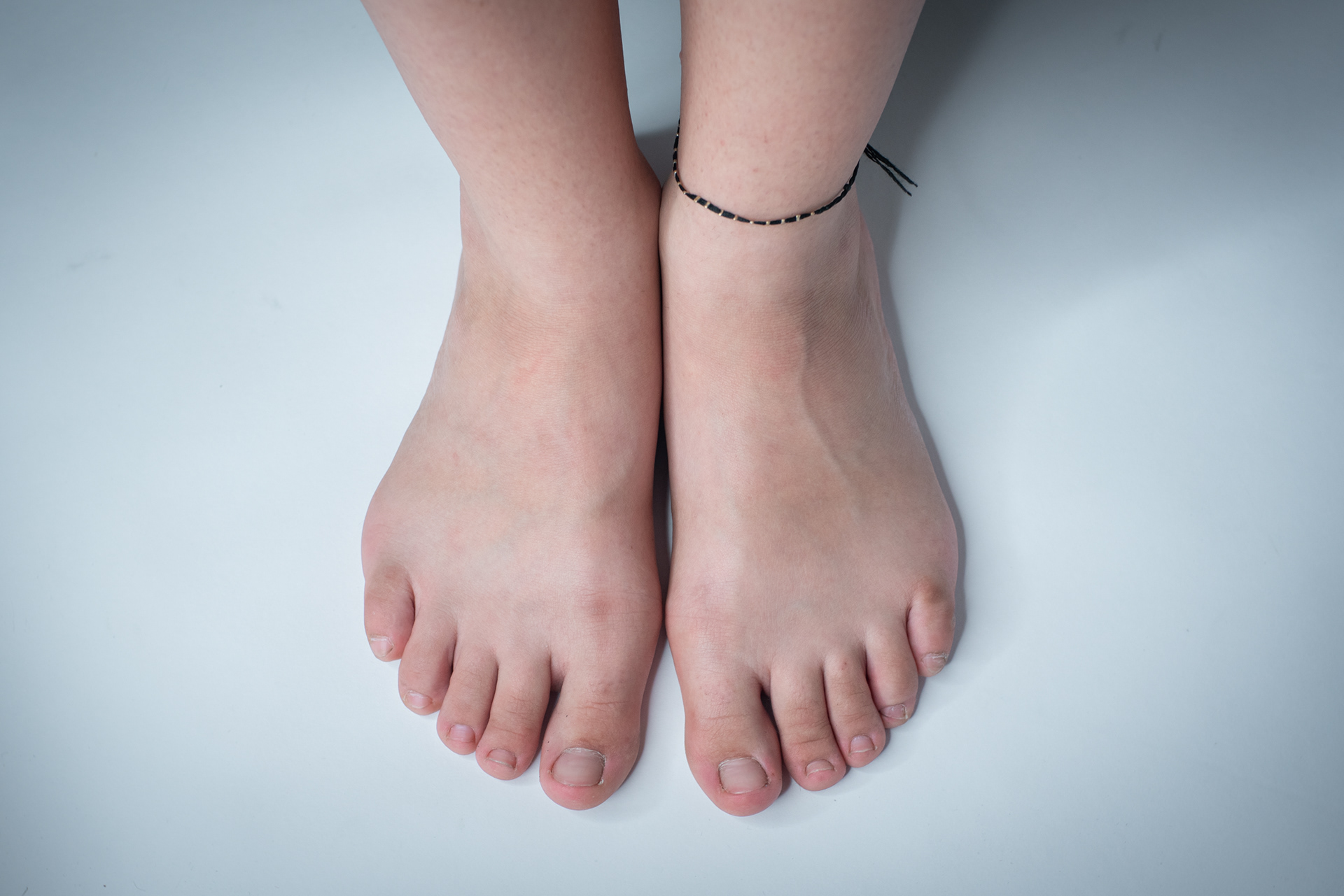 Wide feet