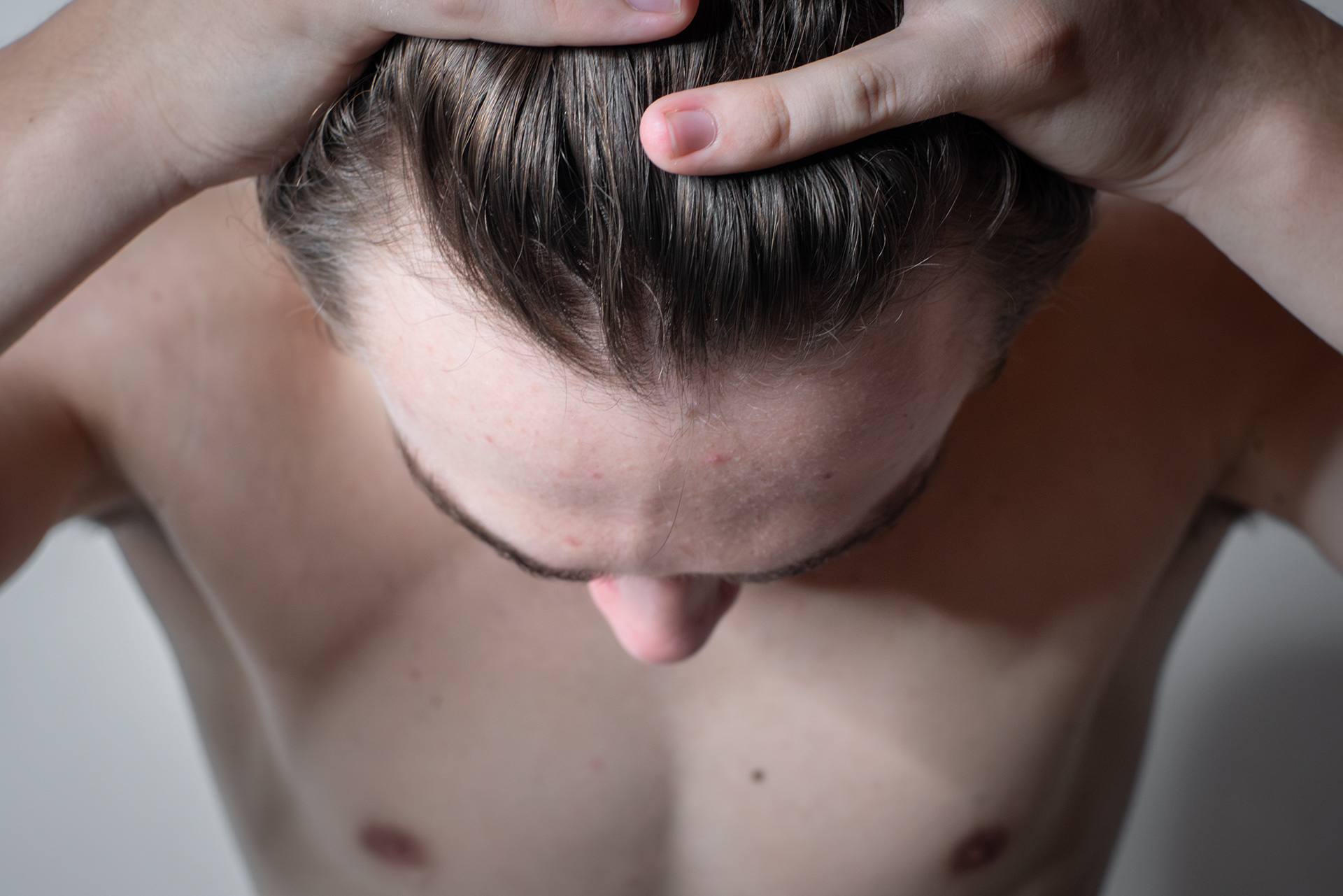 Potential balding