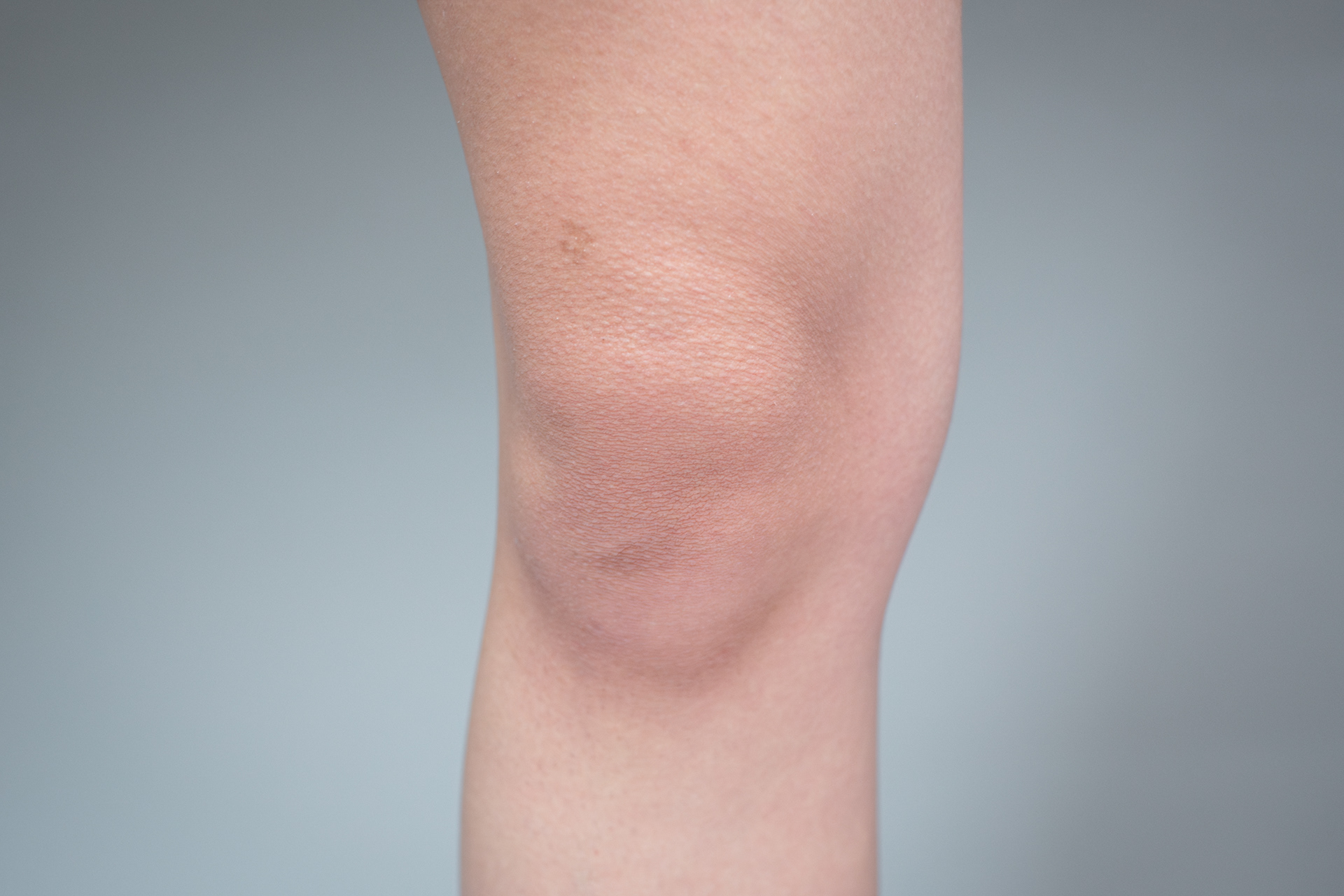 Knees that look like baby faces