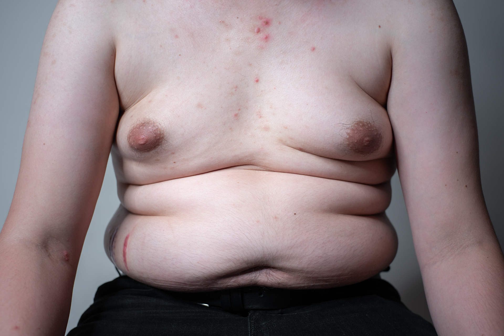 Big belly