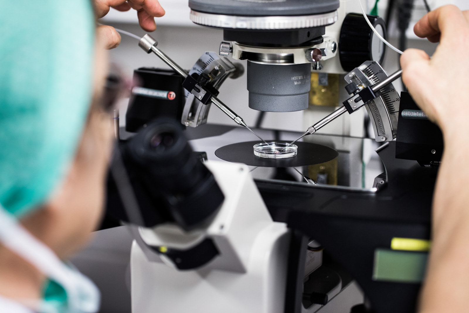 Lapsettomuushoidot, siittiö laitetaan munasolun sisään mikroskoopin avulla.