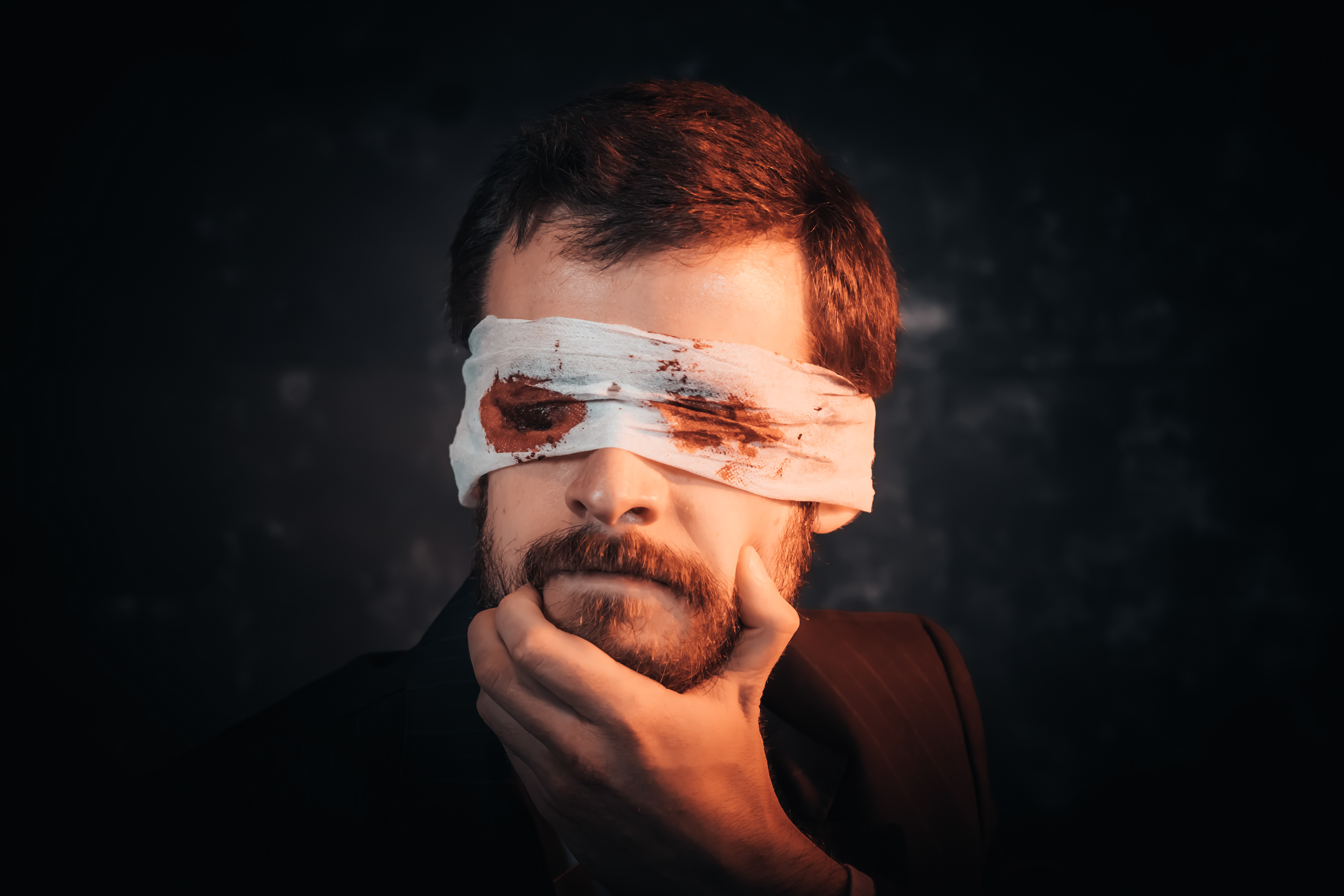 NACHO