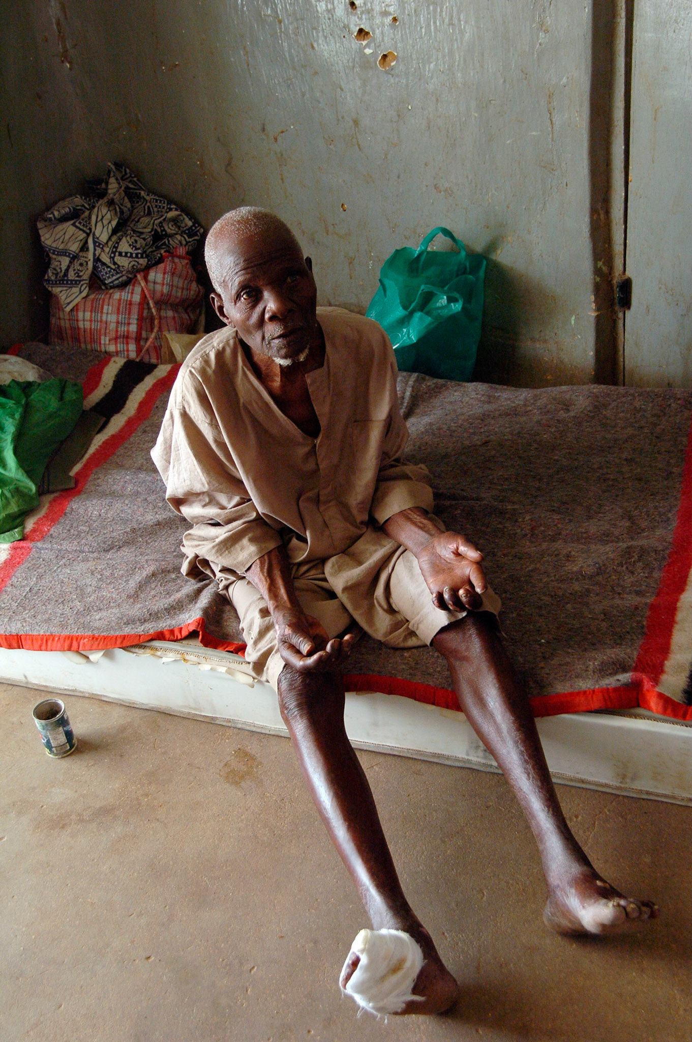 Ondanks dat deze leprapatient goed behandelt wordt in het NTBLTC Lepra en TBC hospital, gaat hij door met bedelen, Zaria (Nigeria) 11 april 2006