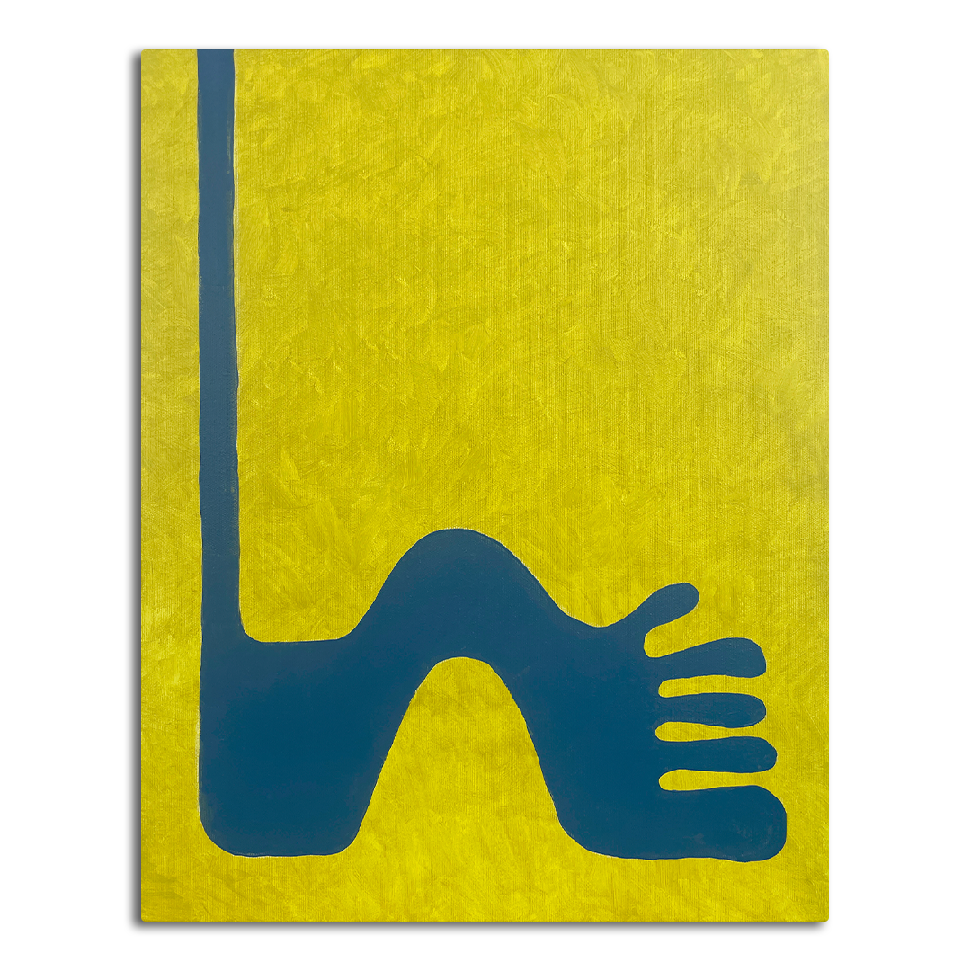 high arches, high standarts