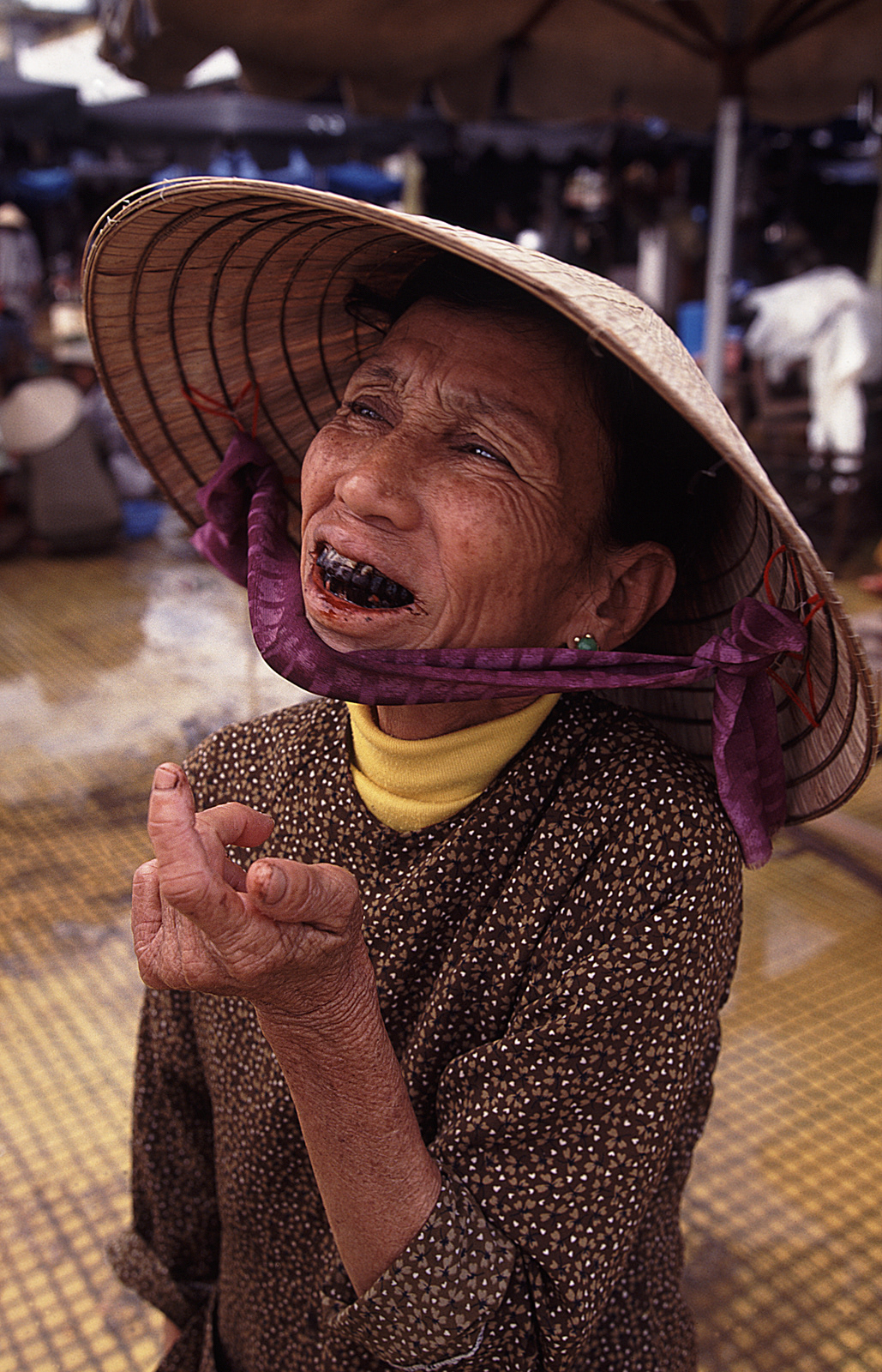 Betel nut stained teeth, Hoi An, Vietnam