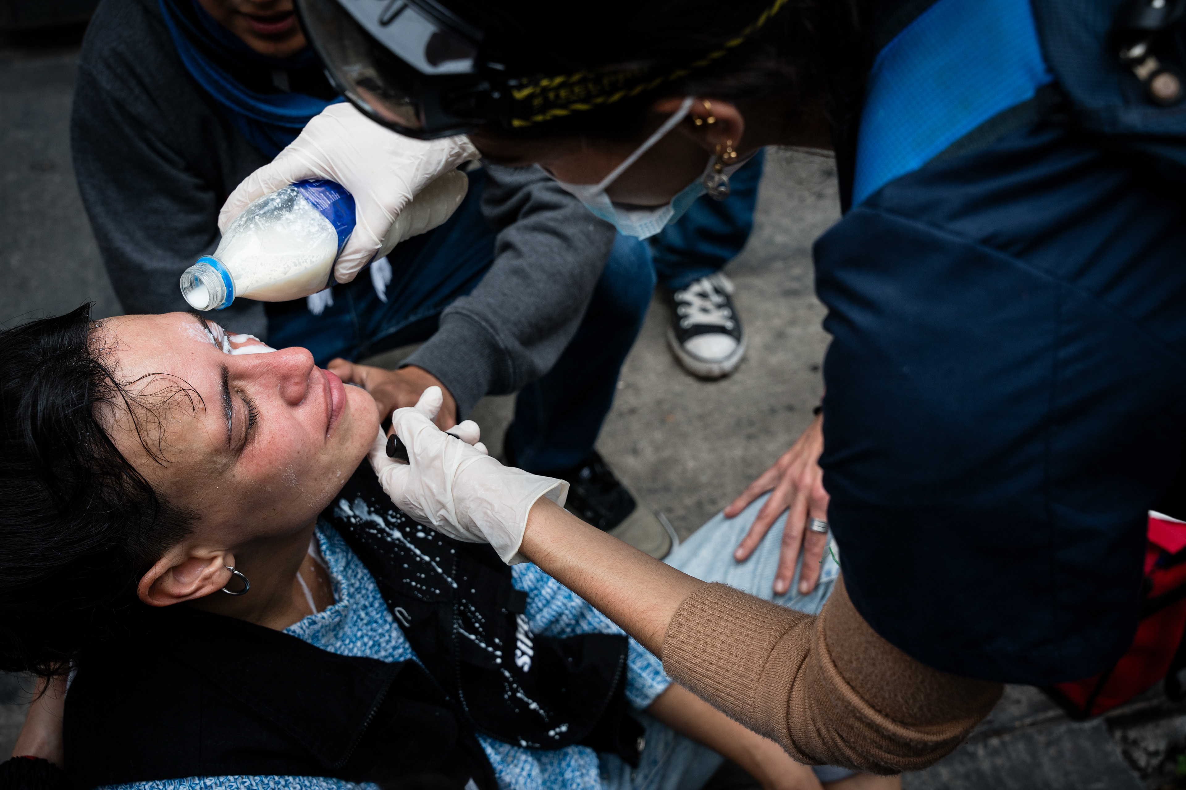 A woman is treated by medics after being pepper sprayed in the face by police during their protest outside while the Senate debates Javier Milei's Ley Bases. The Senate Chamber of the Argentine Congress is debating Javier Milei's Ley Bases, which has already passed the Chamber of Deputies. Meanwhile, hundreds of thousands of demonstrators are protesting in the streets, leading to confrontations and repressive actions by security forces, in Buenos Aires, Argentina, on June 12, 2024. PHOTO: Santiago Oroz