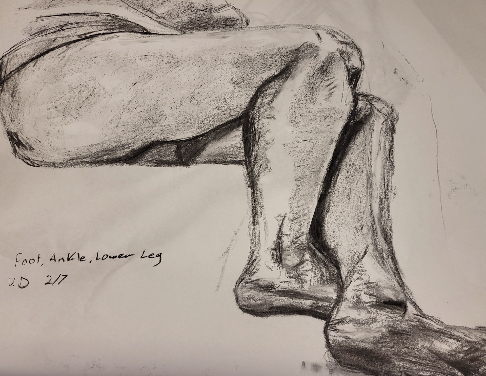 Foot, Ankle, Lower Leg