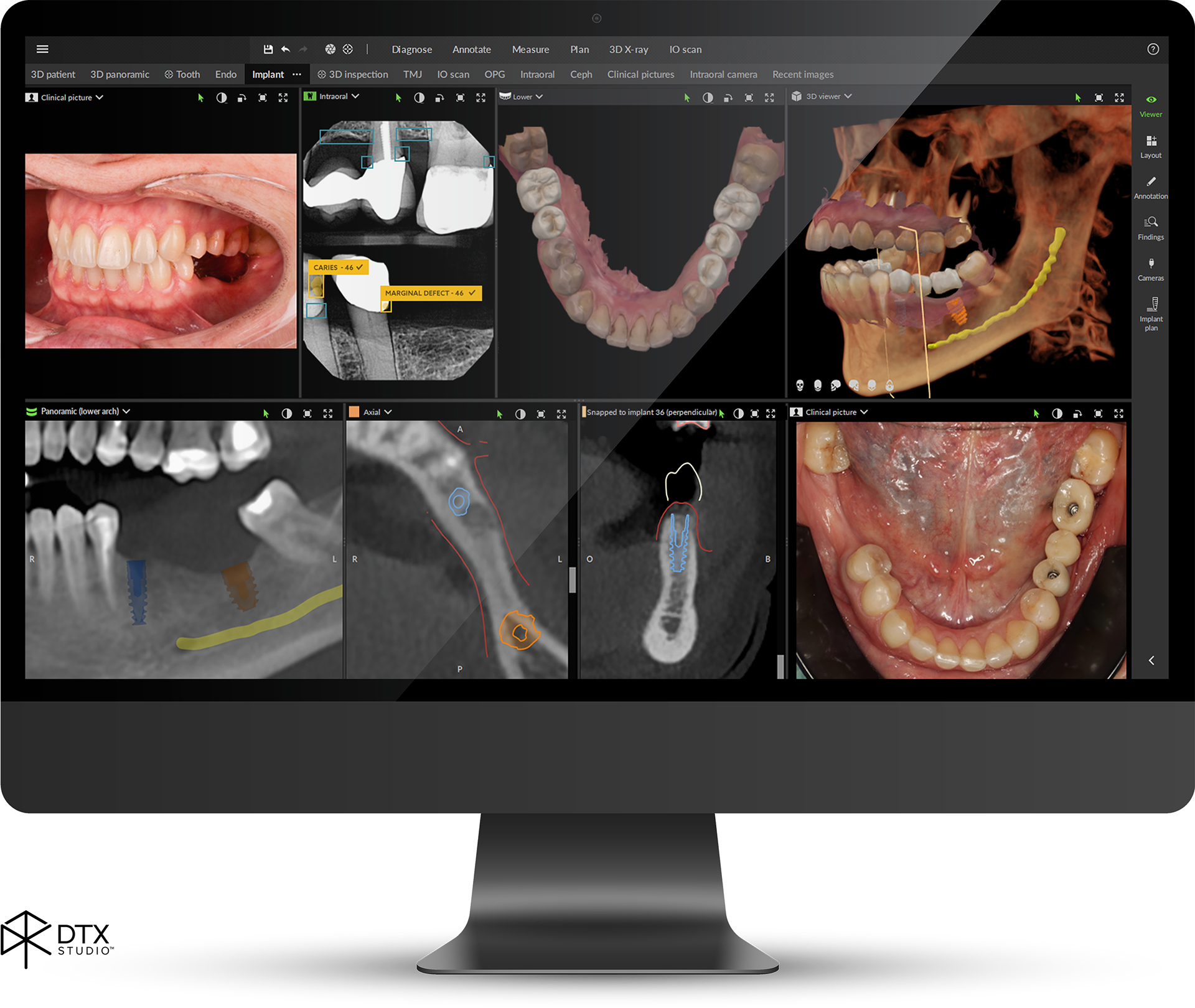 Matériel informatique pour imagerie et gestion Périphériques adaptés au dentaire Claviers tactiles Ecrans imagerie DICOM Logiciels de gestion de cabinet dentaire. Logiciels d’imagerie. Equipement de salle de chirurgie.