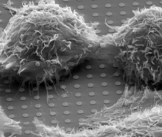 Master's Thesis: Own image of a human cancer cell caught in the moment of cell devision (REM image, 5000x magnitude, LMU Munich, 2014)