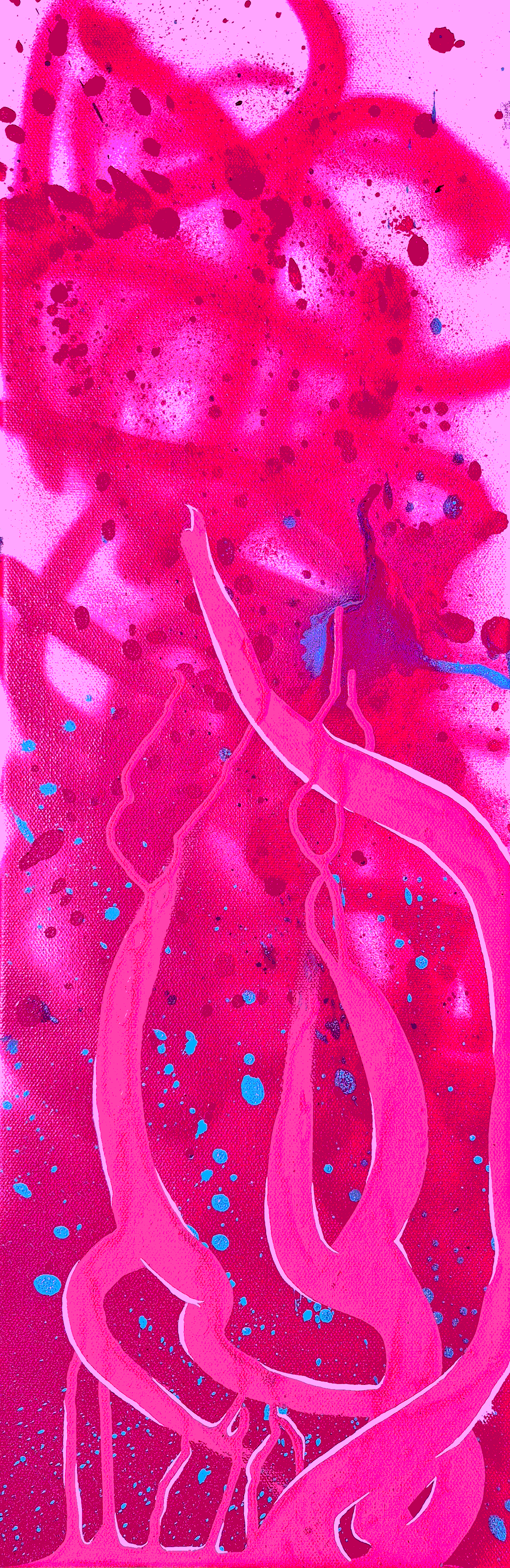 Pink Set (Body)
