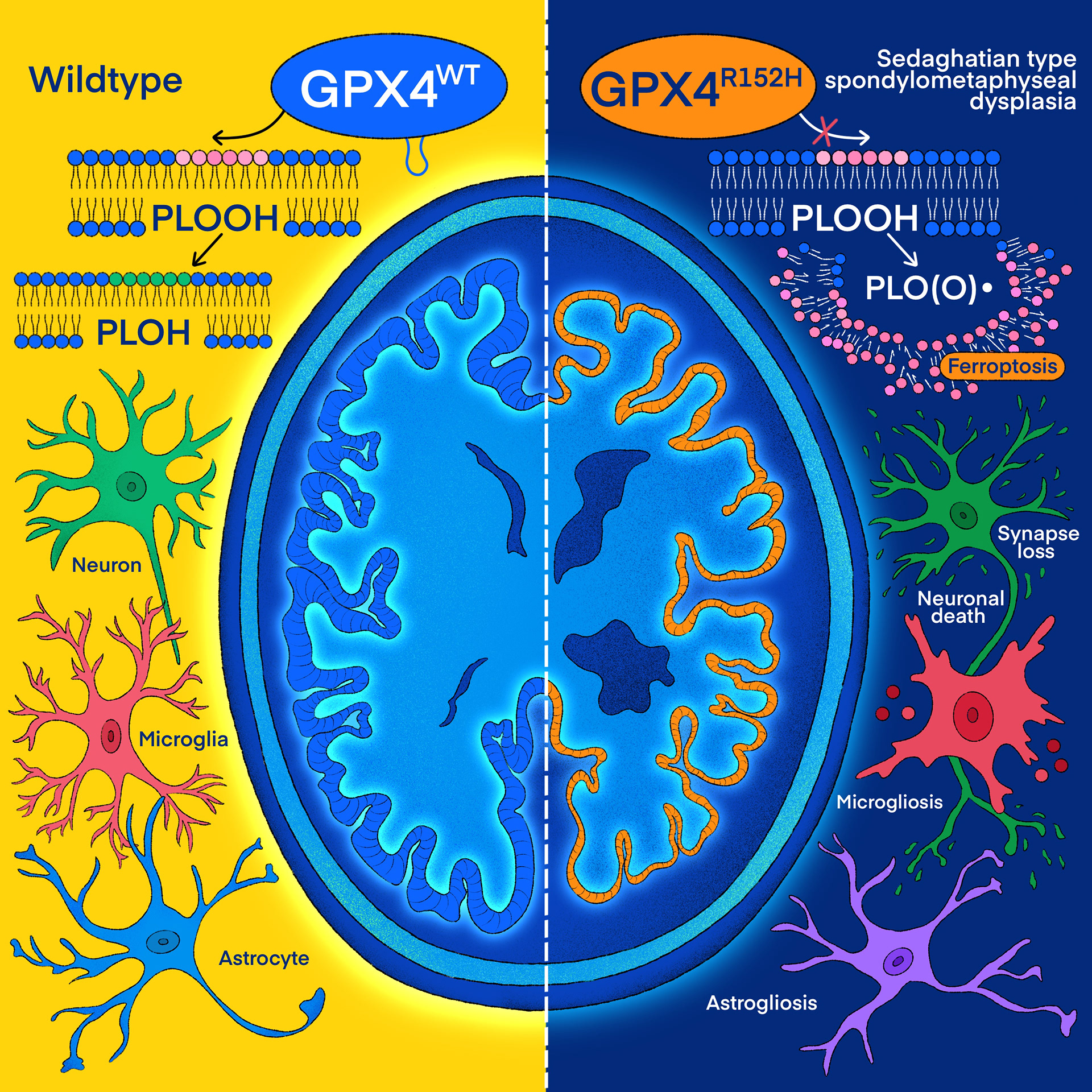 Alzheimer’s disease for "Cell Press"