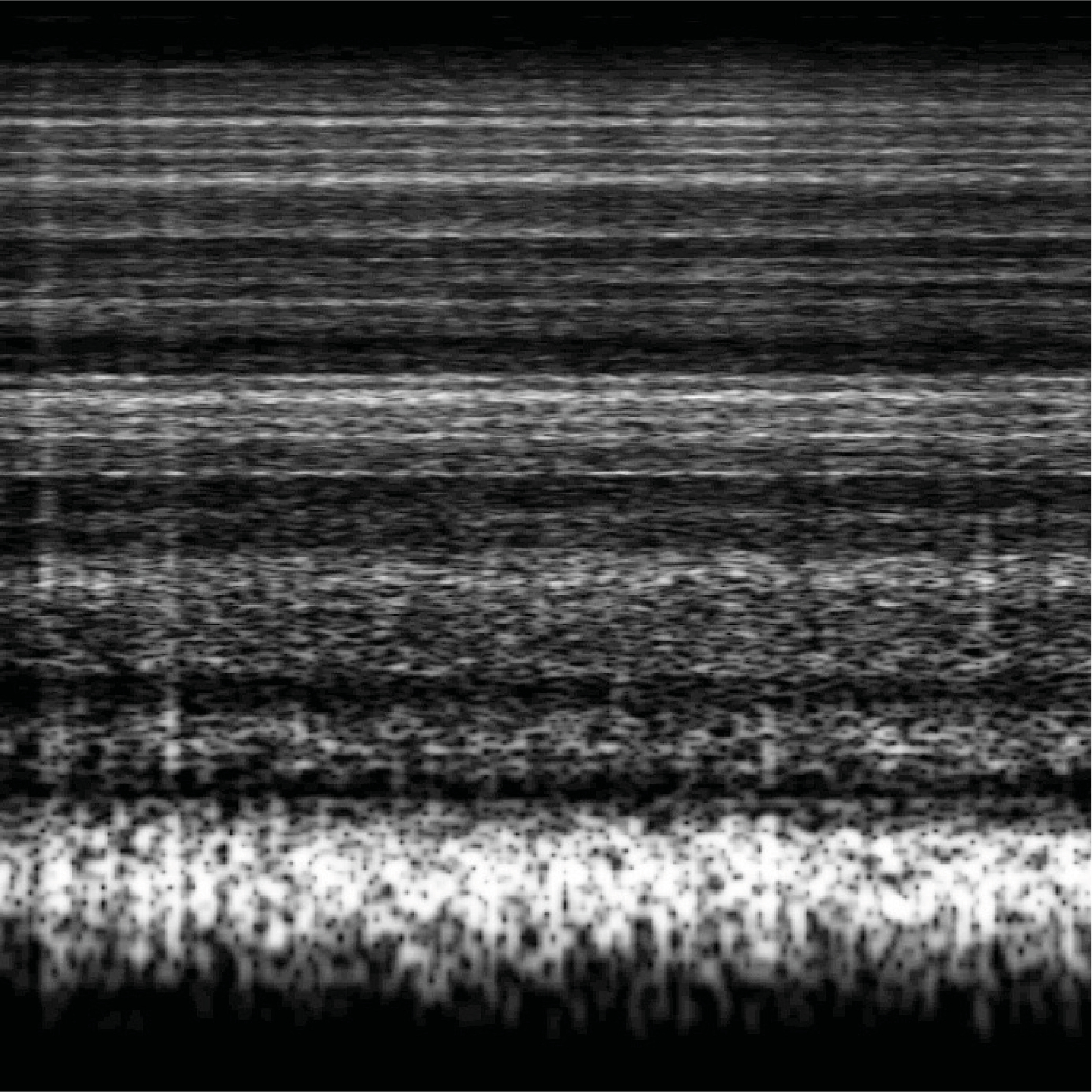 Représentation sonore