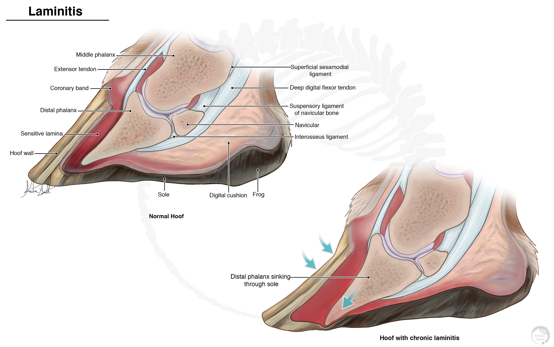 laminitis