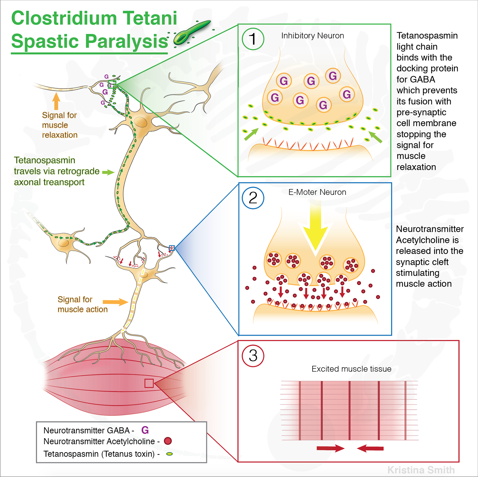 Tetanus Pathway