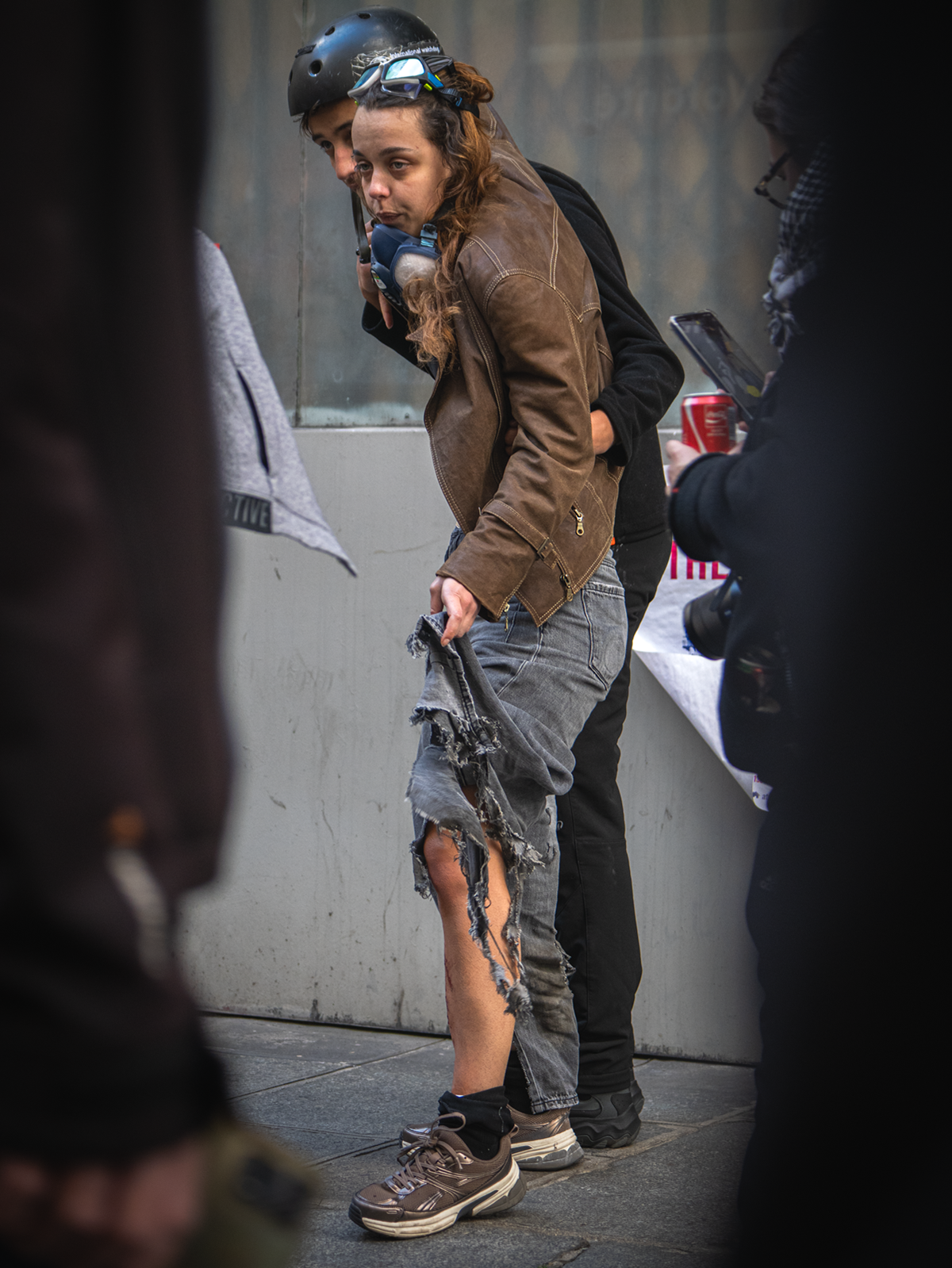 Une jeune journaliste se fait blesser à la jambe par l'explosion d'une grenade