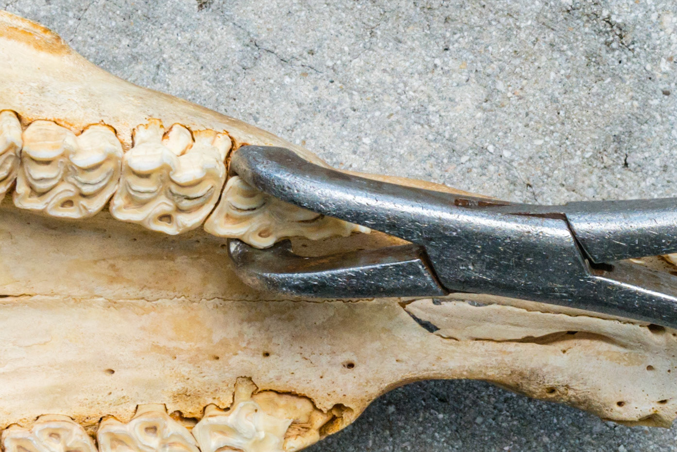 The tips of the jaws of this upper forceps can be seen to grasp only the caudal part of the cap edges of 56. Grasping too far rostrally can fracture the cap requiring a second extraction for the remaining 56. Try to position the forceps tips on the caudal part of the #6 caps.