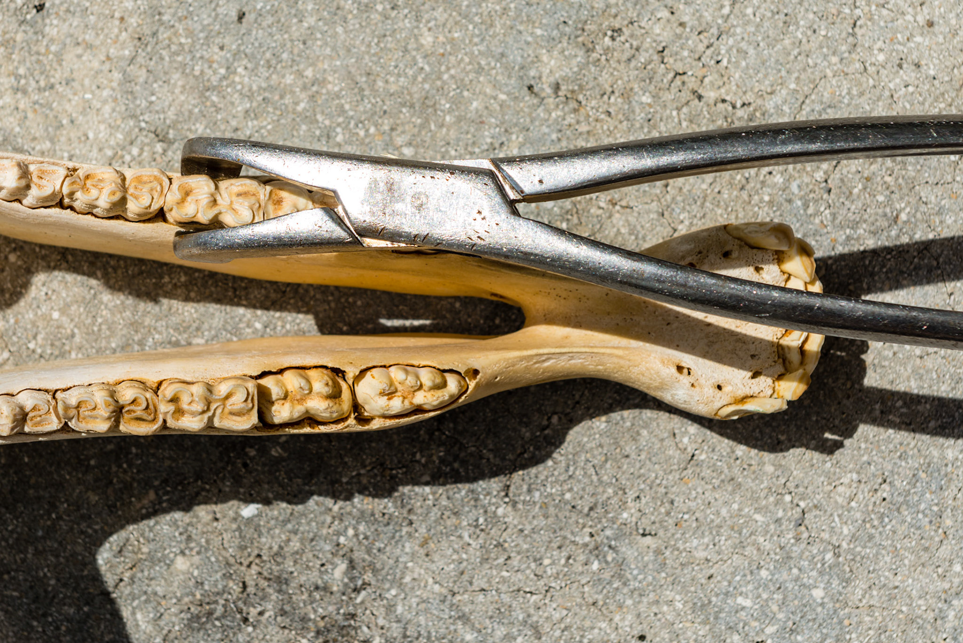 The lower Reynolds cap forceps on 78.