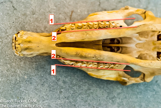 HDS_Anno_Max and Mand teeth