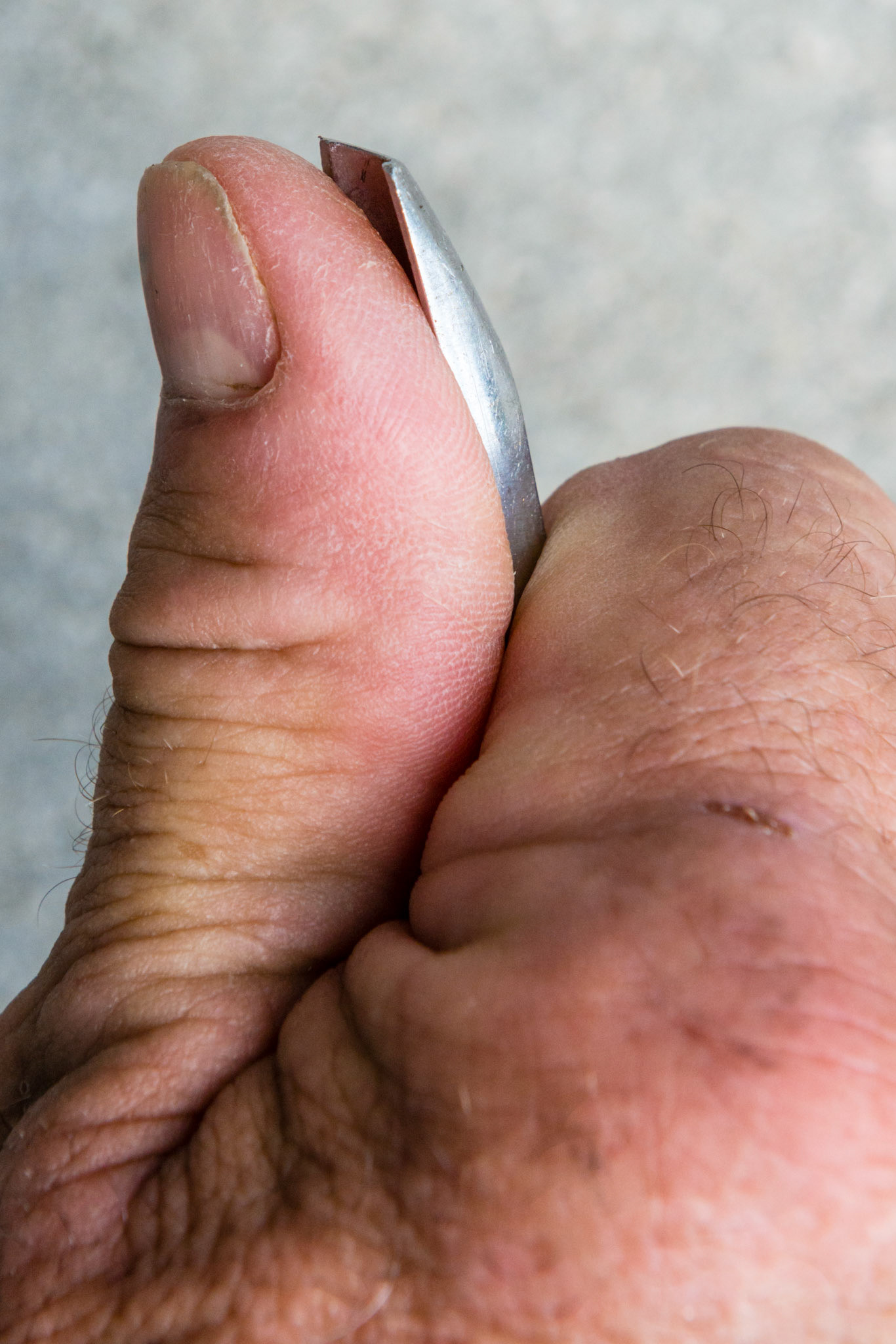 Thumb and flat elevator tip facing up, closed side of fist.