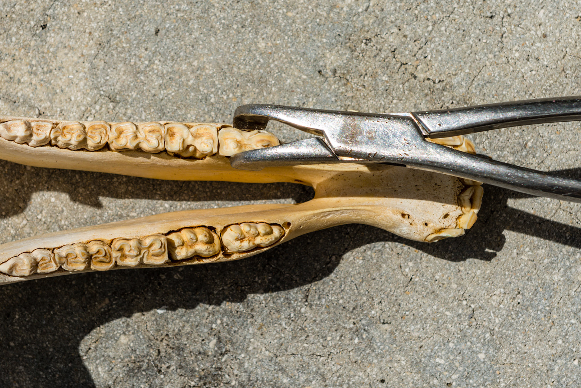 The lower Reynolds cap forceps on 76.