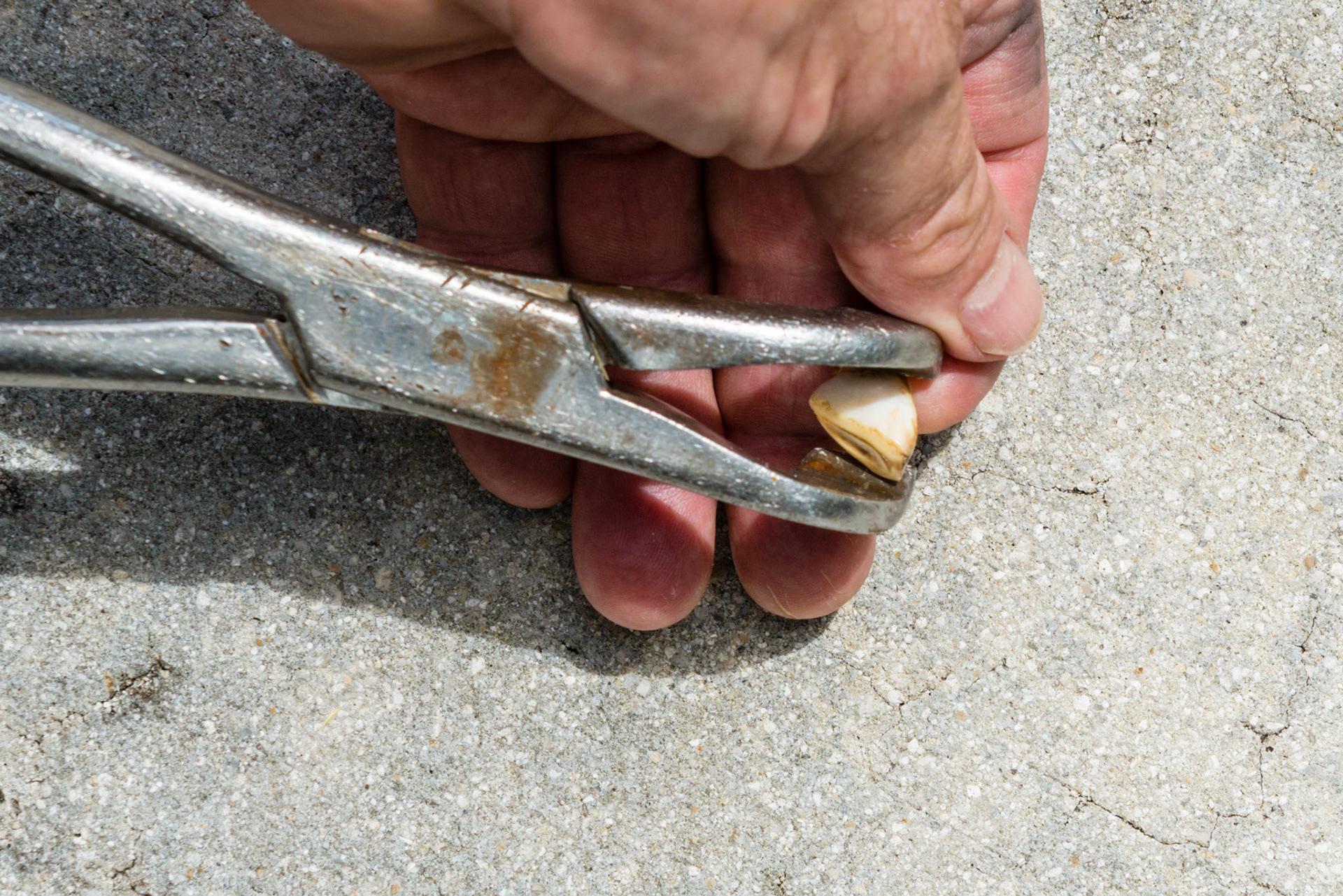 Another position for extracting an incisor cap. One tip of the forceps is placed on the distal lingual edge and the other tip is placed on the proximal labial edge. The forceps are rotated drawing the caudal lingual edge away from the horse and pivoting on the proximal labial edge. This works even on incisor caps that have already loosened their proximal ends from the gum line.