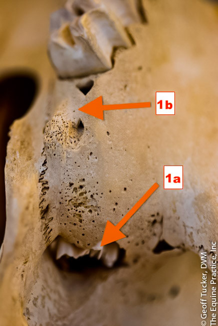HDS_Anno_Unerupted teeth