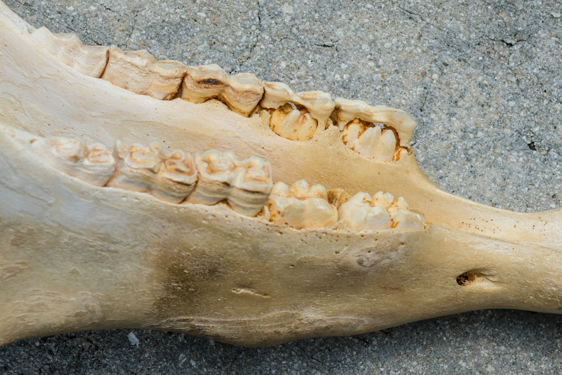 Different stages of cap maturity. Notice the degree of space between the lingual edge of caps 76 and 77 and the edge between the mandible and underlying permanent tooth. These two caps are mature and food mixed with saliva can get underneath the cap and create a fermented smell. Fingers placed in these areas will feel this space and will also pick up the odor. Compare this to no space under the 78 cap which is not mature and not ready for extraction in this 3 year old.